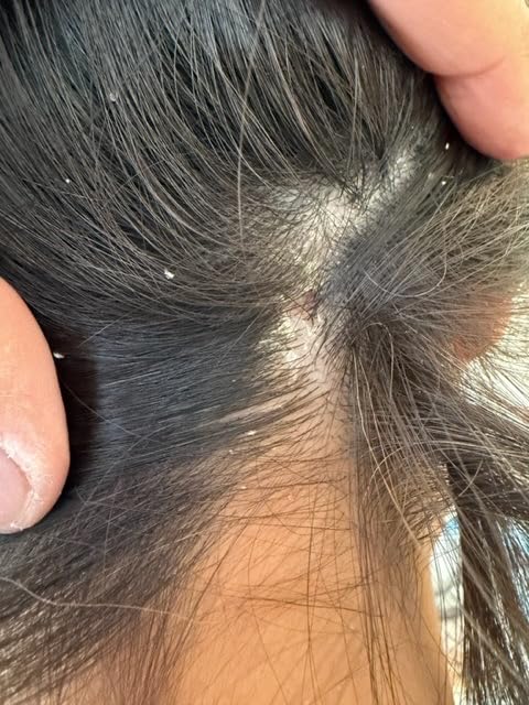 Naturtint 5N Light Chestnut Brown Permanent Hair Color, Ammonia Free, Vegan, Cruelty Free, up to 100% Gray Coverage, Long Lasting Results customer photo 2