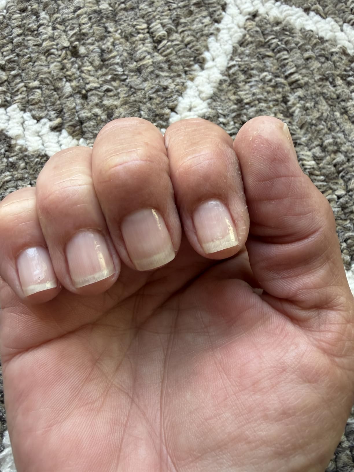 Nailtiques Formula 2 Nail Protein 0.5 oz customer photo 2