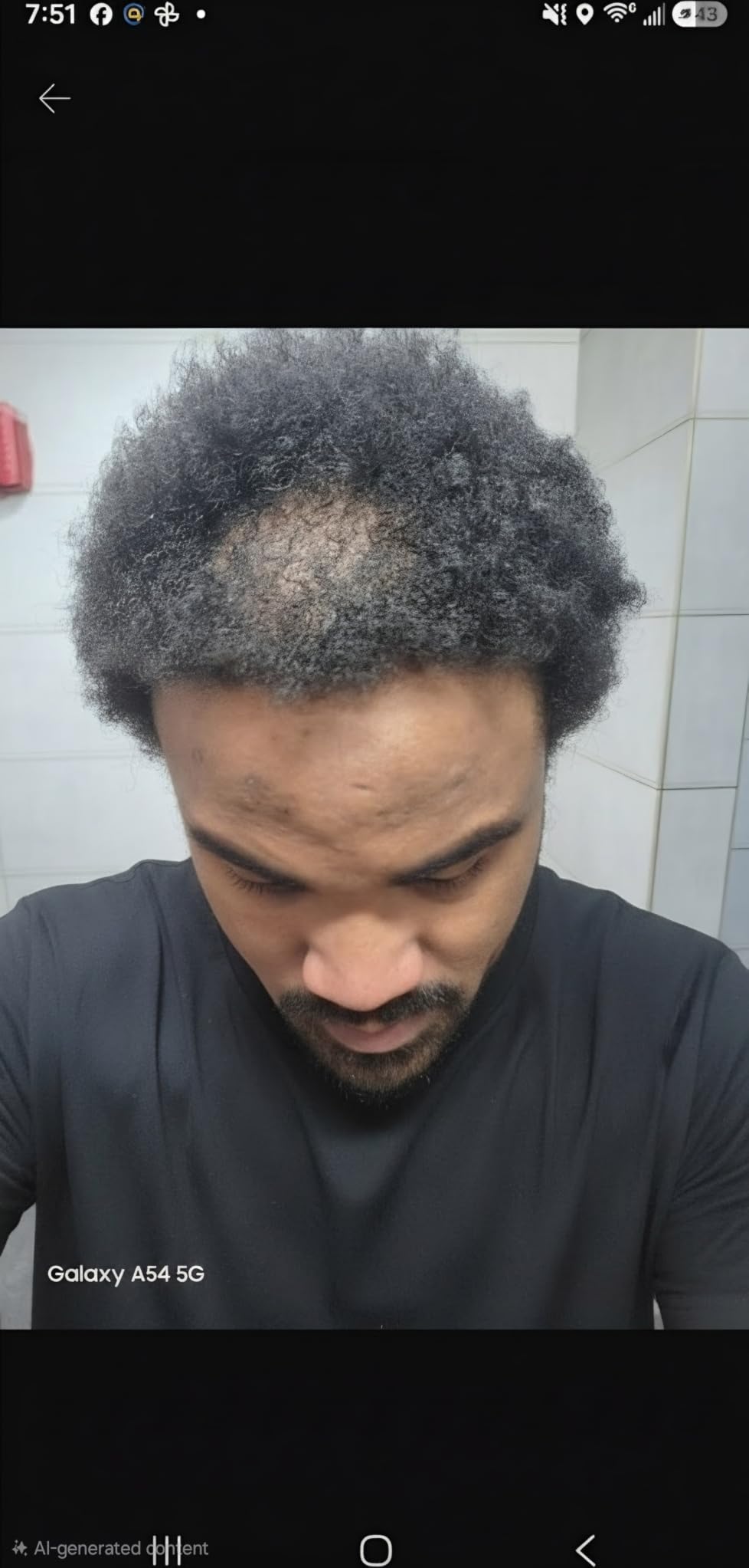 DHT Blocker - Hair Growth Supplement for Genetic Thinning for Men and Women | Guaranteed, Backed by 20 Years of Experience in Hair Loss Treatment Clinics customer photo 1