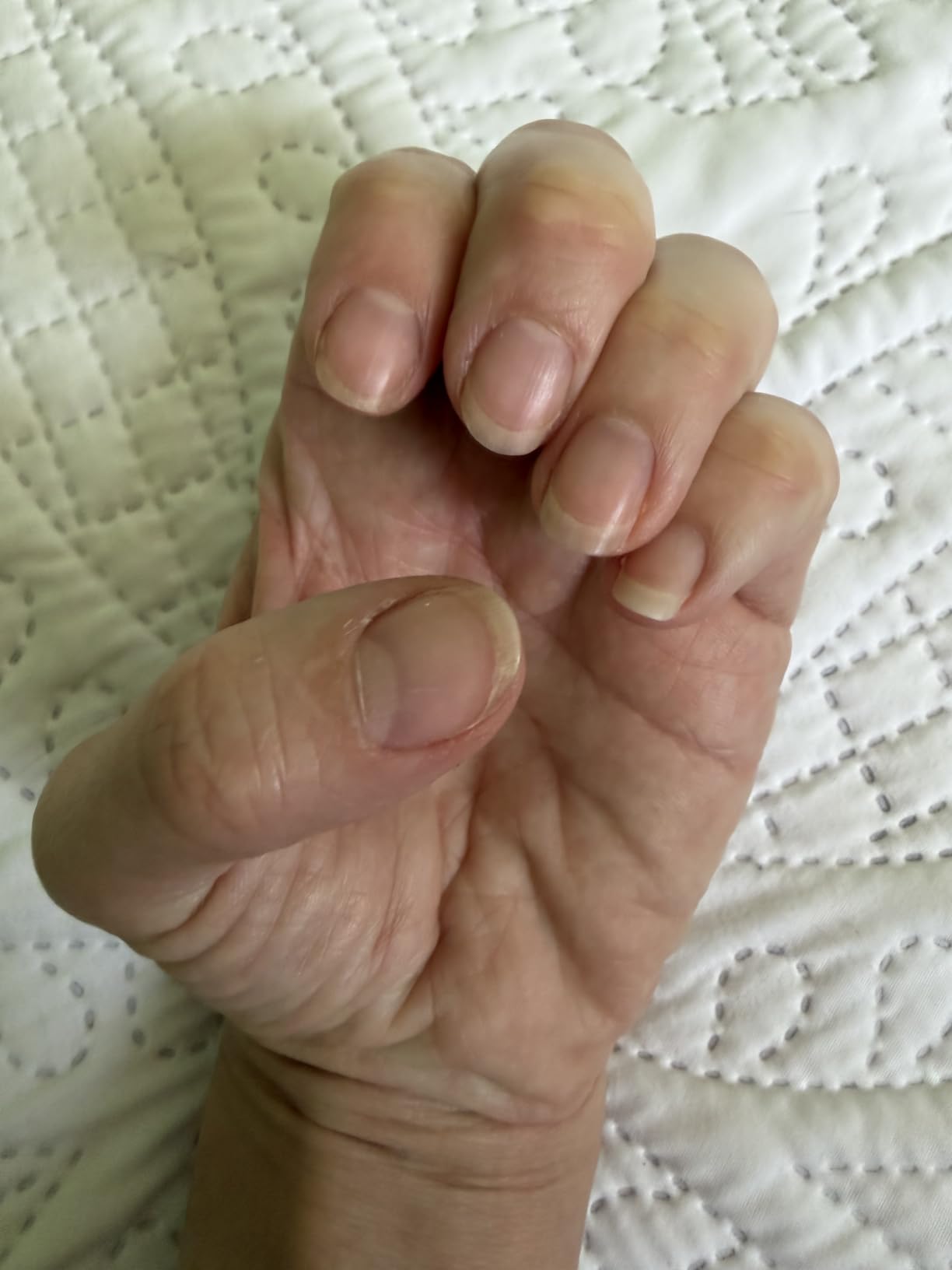 Onyx Professional Hard as Hoof Nail Strengthening Cream, Island Coconut Scent customer photo 1