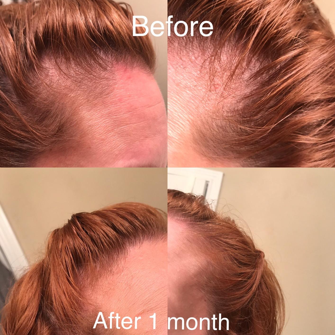 Vinegar Nutritive Rinse | Natural Hair Care to Revitalize Hair and Scalp | Prevents Hair Loss | Just Nutritive | 8 Oz customer photo 1