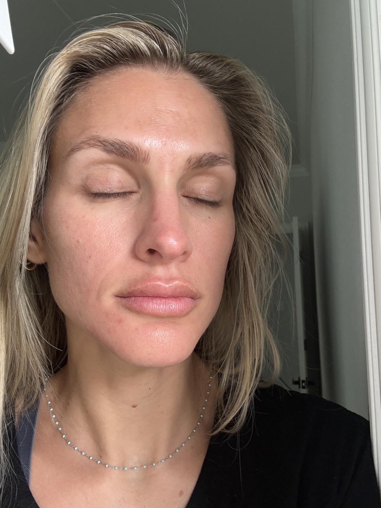 Paula's Choice SKIN PERFECTING 2% BHA Liquid Exfoliant with Salicylic Acid, Facial Polish for Pores, Wrinkles & Fine Lines, Suitable for Blackhead-Prone Skin, Fragrance-Free customer photo 2