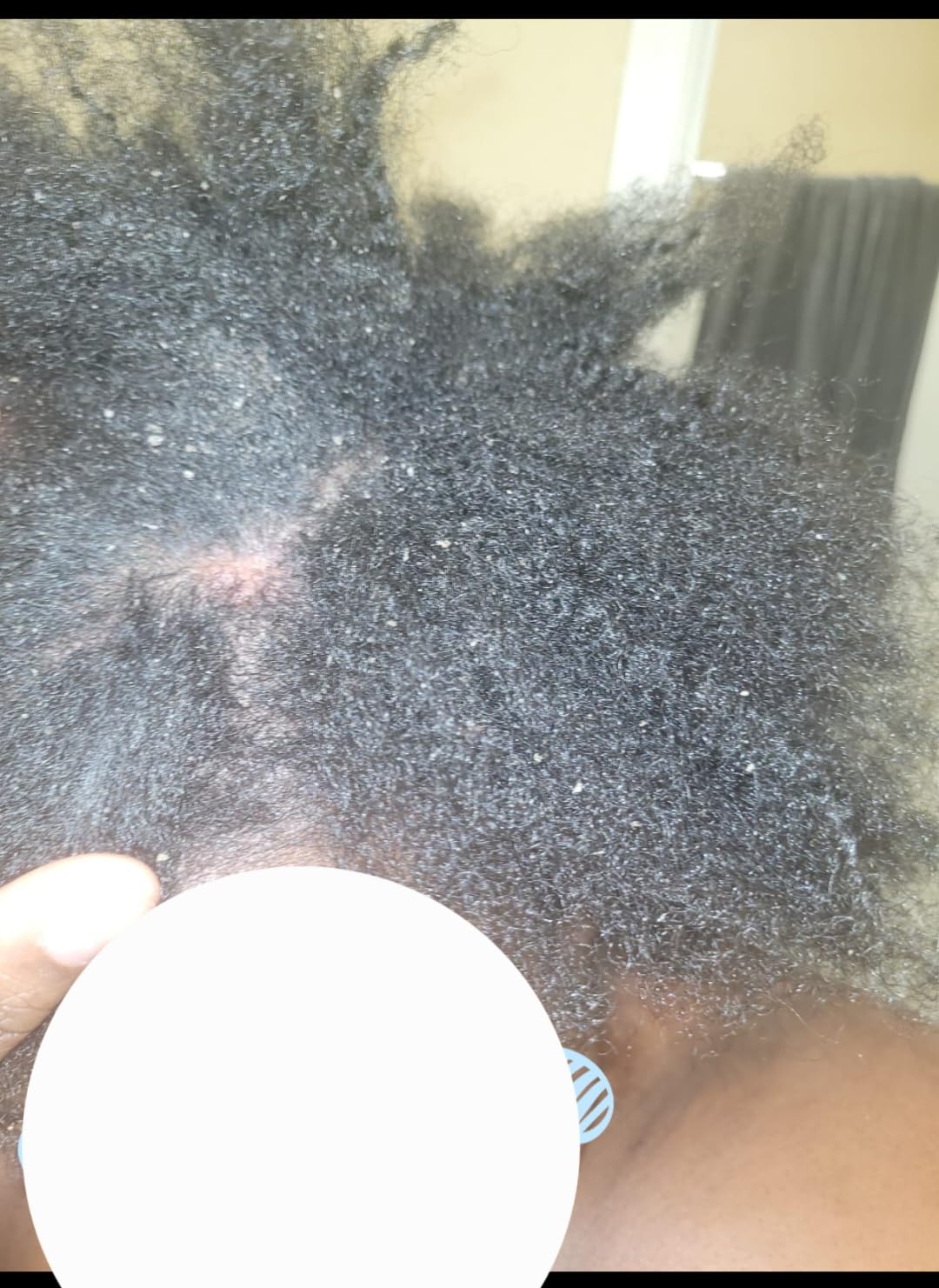 Nizoral Anti-Dandruff Shampoo with 1% Ketoconazole, Fresh Scent, 7 Fl Oz customer photo 2