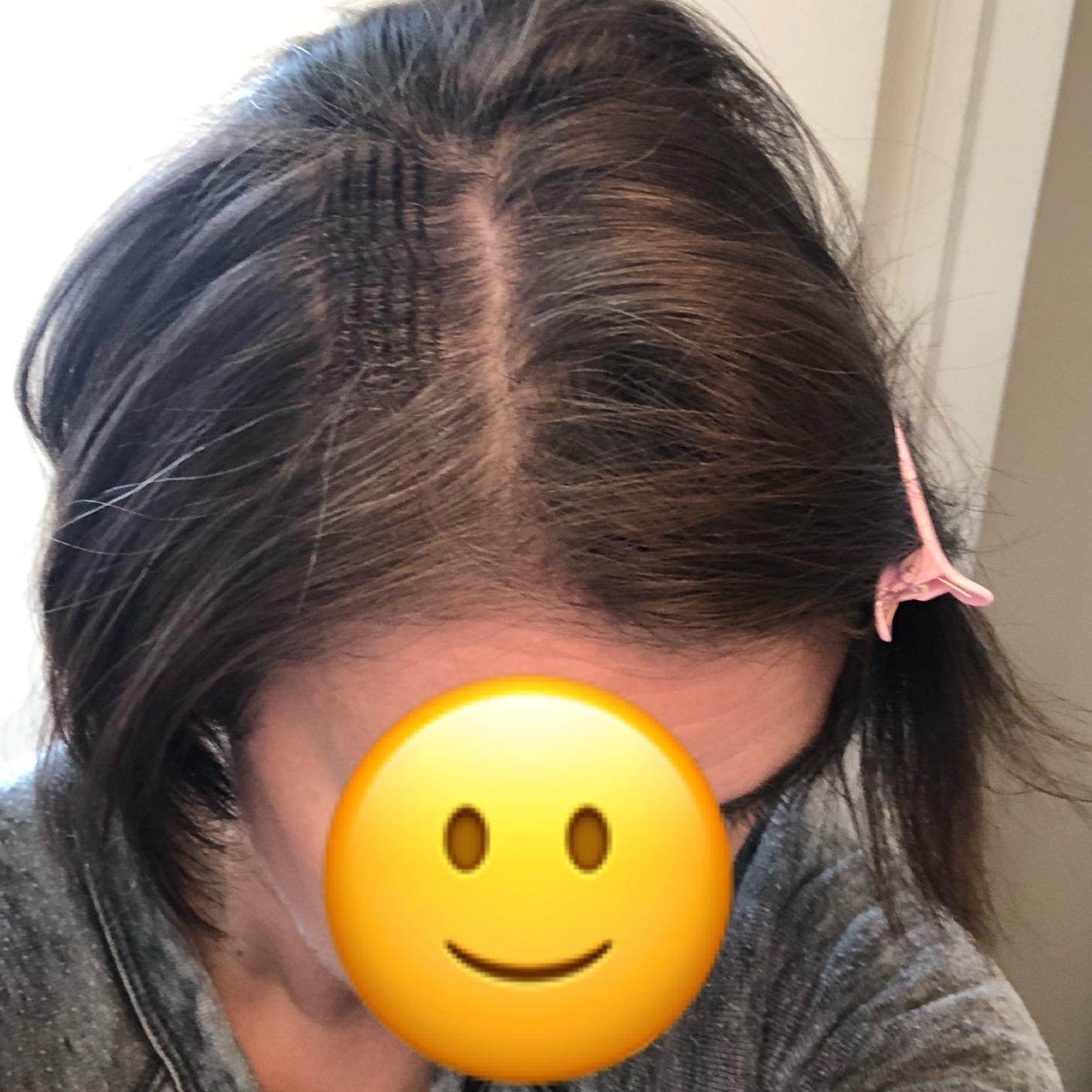 Bed Head Little Tease Hair Crimper | Small Texture, Pumped-Up Volume, & Extra Shine | Crimper Hair Tool with Tourmaline Ceramic Coating for Less Damage (1 in) customer photo 2