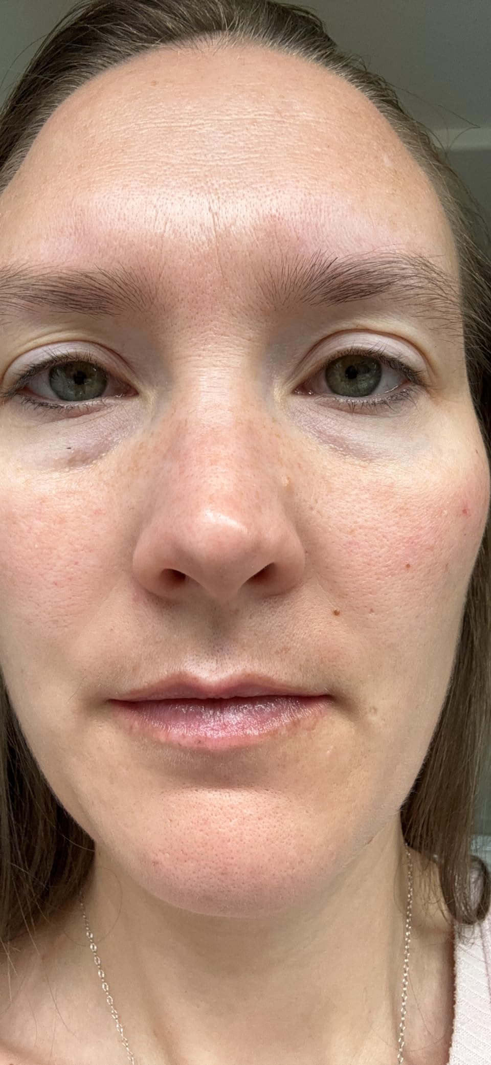 Paula's Choice BOOST 10% Niacinamide Face Serum Booster with Vitamin B3, Vitamin C & Licorice Extract, Pore Minimizer, All Skin Types, Fragrance-Free, 0.67 oz customer photo 1