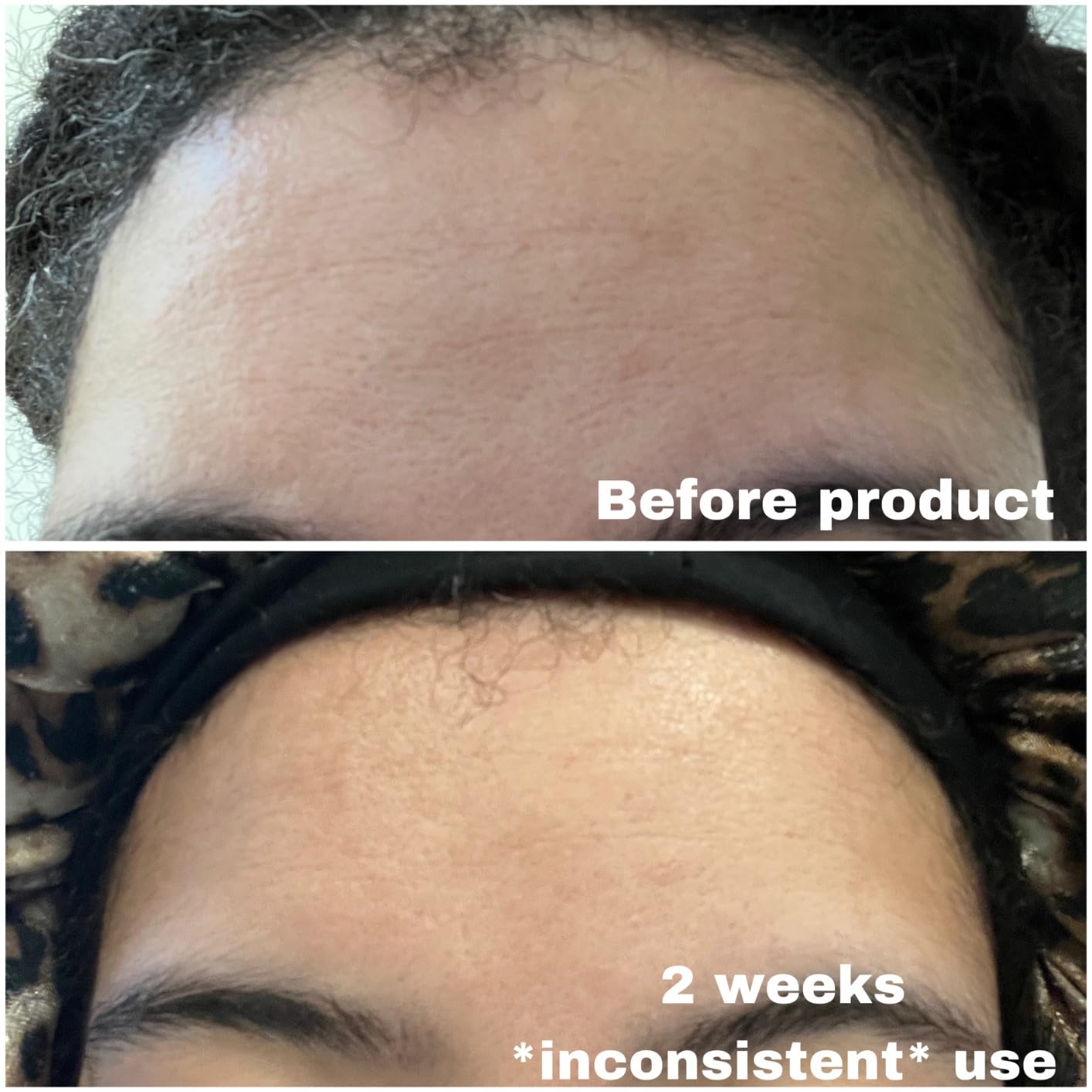 Neutrogena Rapid Wrinkle Repair Retinol Face Moisturizer 1.7 oz customer photo 2
