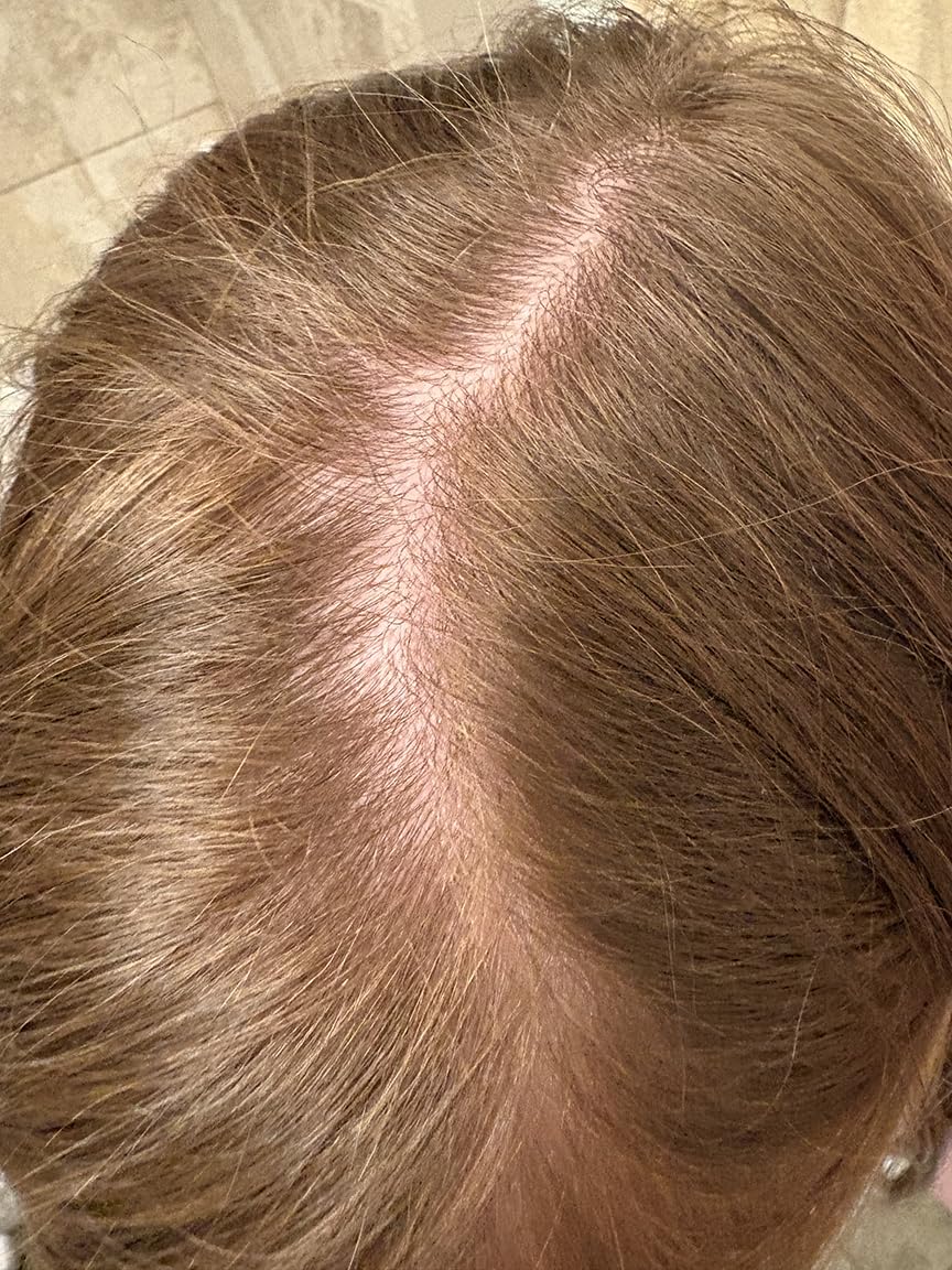 Nourishing Kids Shampoo for Dry Scalp - Gentle Dry Scalp Care Shampoo for Kids with Cleansing Essential Oils for Kids - Clarifying Shampoo for Build Up and Dry Flaky Scalp with Tea Tree Oil for Hair customer photo 1