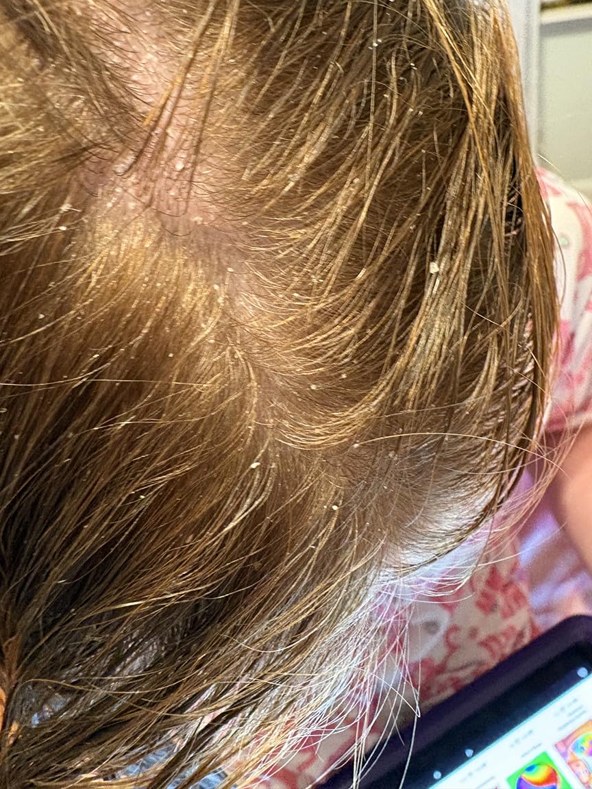 Nourishing Kids Shampoo for Dry Scalp - Gentle Dry Scalp Care Shampoo for Kids with Cleansing Essential Oils for Kids - Clarifying Shampoo for Build Up and Dry Flaky Scalp with Tea Tree Oil for Hair customer photo 2