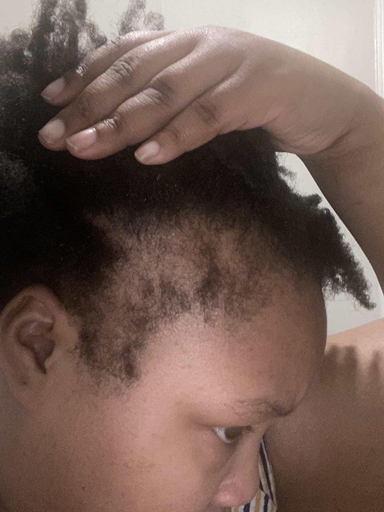 Biotin Hair Growth Serum Advanced Topical Formula To Help Grow Healthy, Strong Hair Suitable for Men and Women of All Hair Types Hair Loss Support By Pureauty Naturals 2 Fl Oz (Pack of 1) customer photo 1