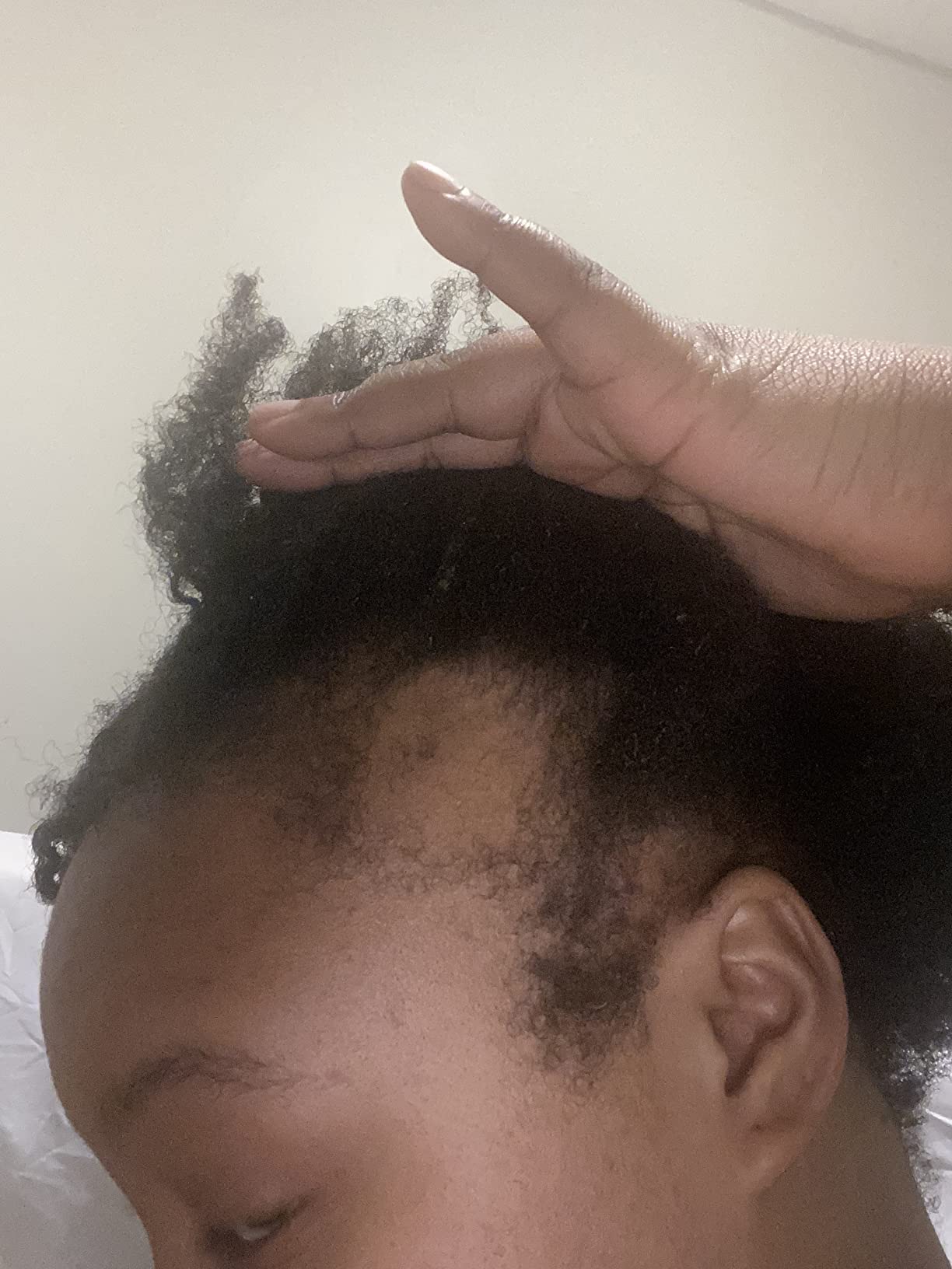 Biotin Hair Growth Serum Advanced Topical Formula To Help Grow Healthy, Strong Hair Suitable for Men and Women of All Hair Types Hair Loss Support By Pureauty Naturals 2 Fl Oz (Pack of 1) customer photo 2