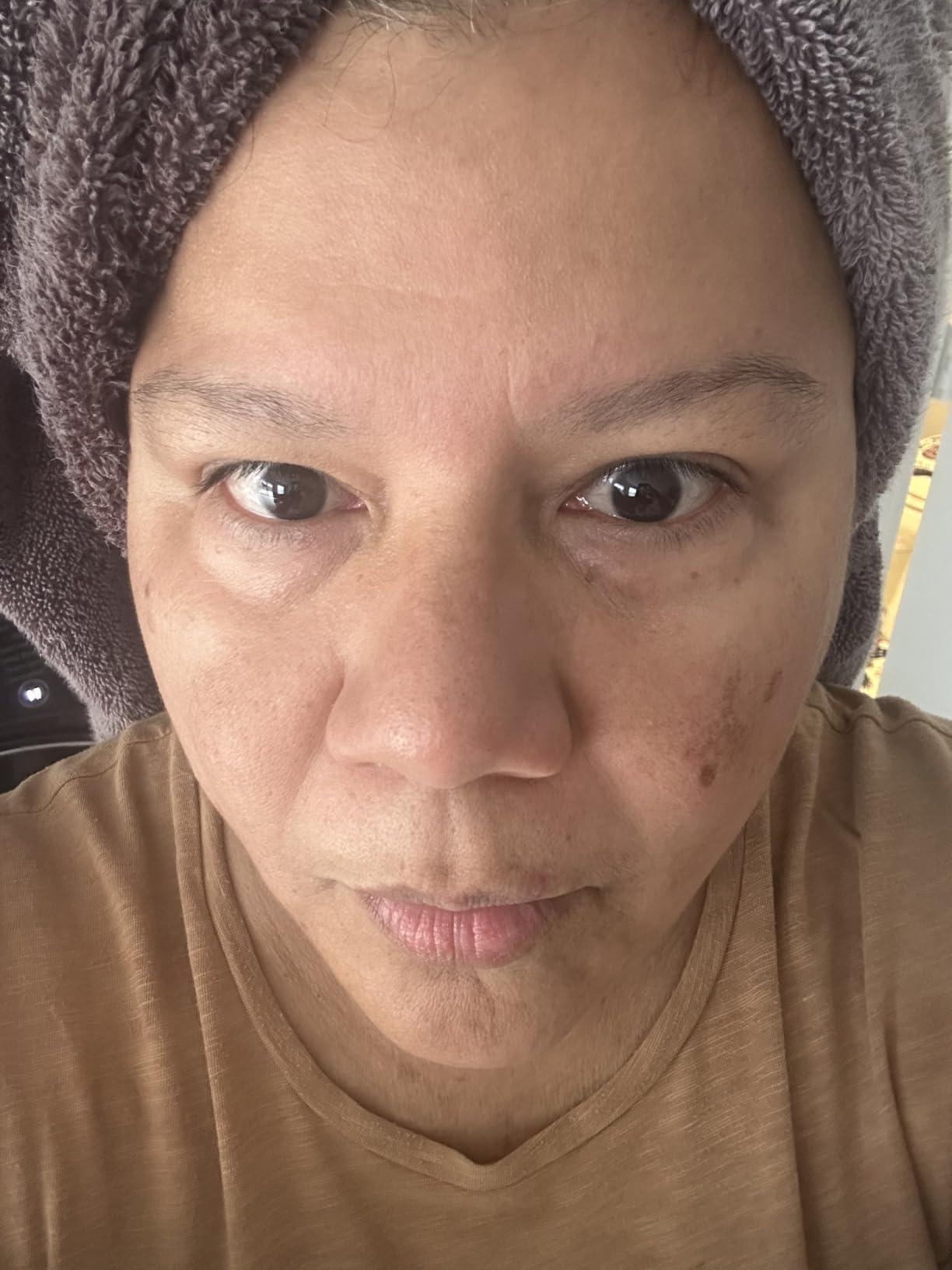 The Ordinary Retinol 0.2% in Squalane, Gentle Retinol Serum for the Face That Is Anti-Aging and Skin Smoothing, 1 Fl Oz customer photo 1