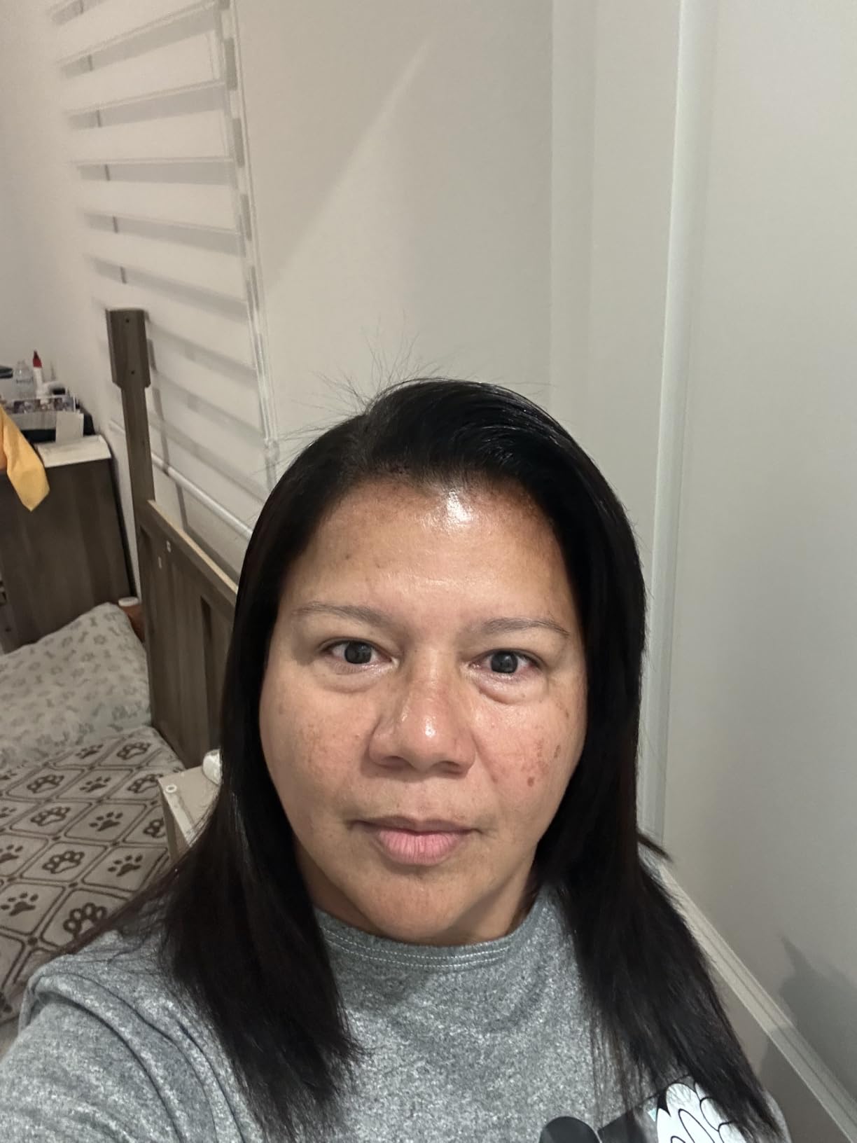 The Ordinary Retinol 0.2% in Squalane, Gentle Retinol Serum for the Face That Is Anti-Aging and Skin Smoothing, 1 Fl Oz customer photo 2