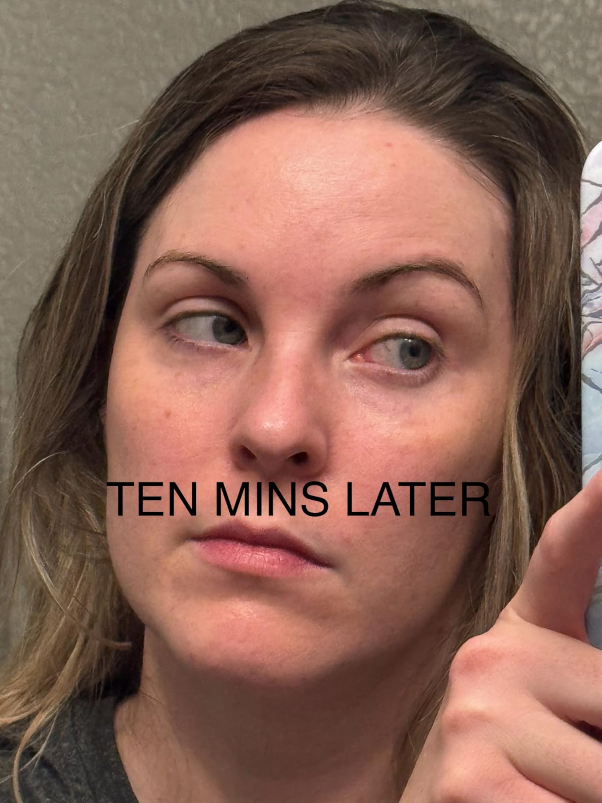 The Ordinary Serum Favorites Set - Hyaluronic Acid 2% + B5, Niacinamide 10% + Zinc 1%, Caffeine Solution 5% + EGCG Eye Serum for Hydrating, Brightening & Pore-Minimizing customer photo 2