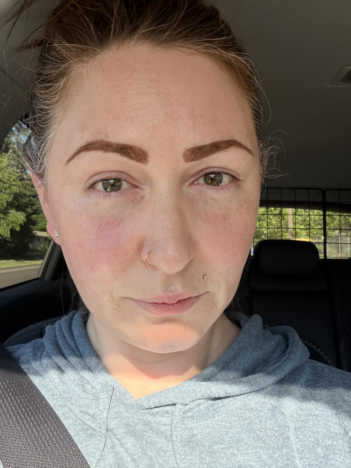 The Ordinary The Daily Set, Daily Skincare Routine with Squalane Cleanser, Hyaluronic Acid 2% + B5, and Natural Moisturizing Factors + HA | Skin Care Set customer photo 1
