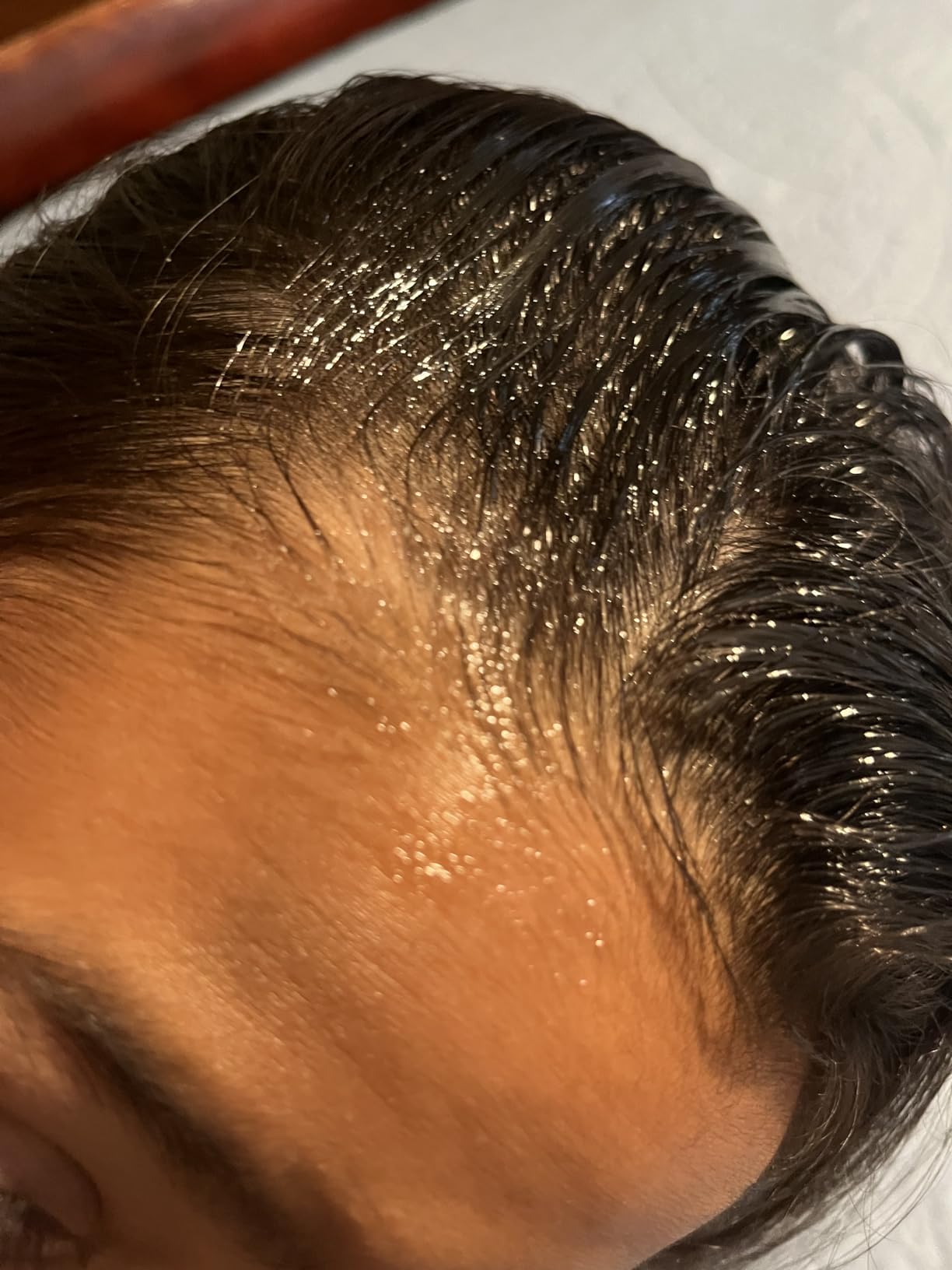 Ladibugs Cradle Cap Remedy Kit - 2-Step Serum & Comb Scale Remover | Includes Cradle Cap Serum & Fine-Toothed Comb, Effectively Removes Scales & Flakes, Soothes & Softens Scalp customer photo 1