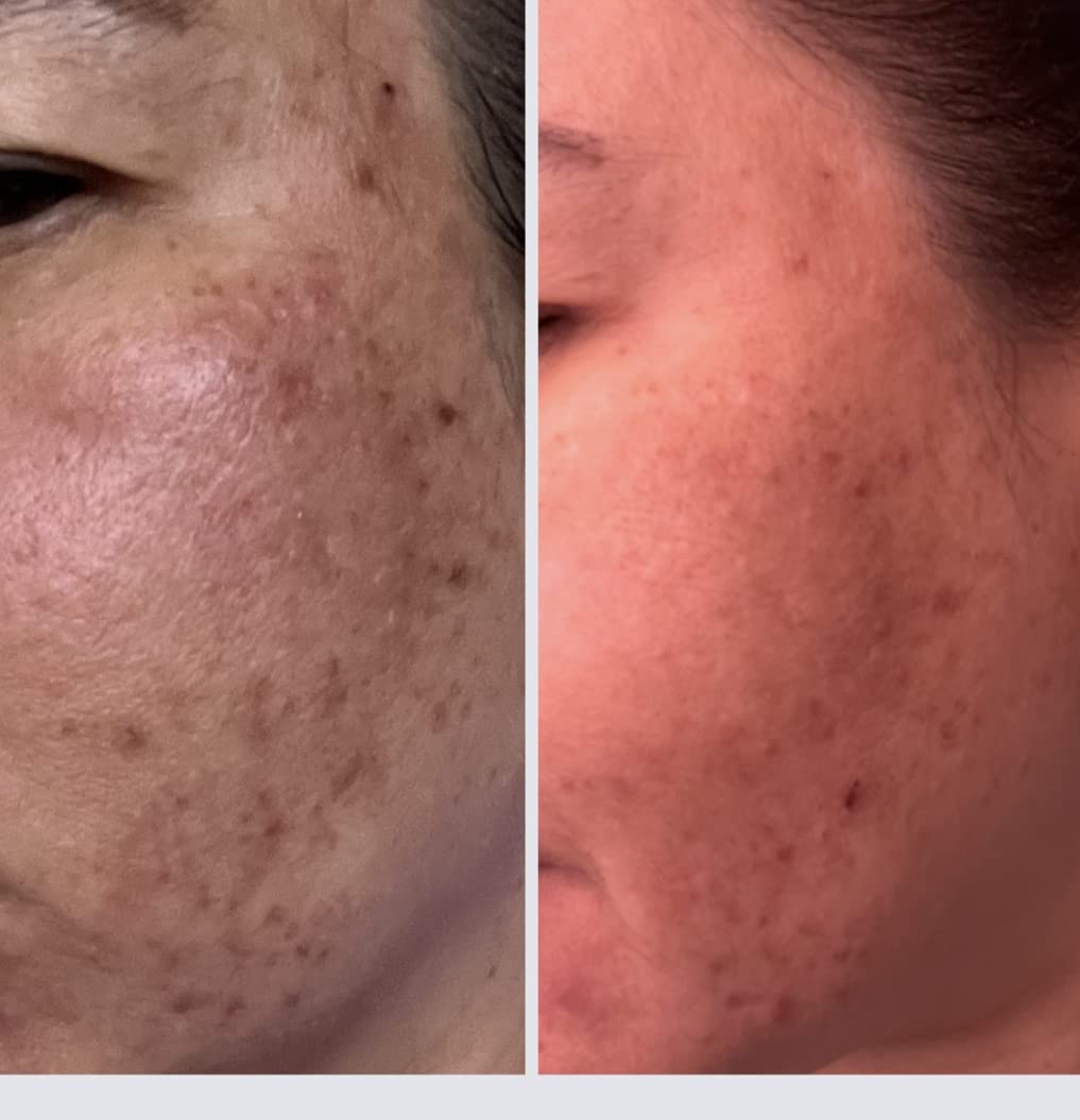 Cos De BAHA Niacinamide 10% Serum 2 Fl Oz - Zinc PCA, Hyaluronic Acid & Aloe for Balancing, Pore-Refining & Uneven Tone (60 ml) customer photo 1