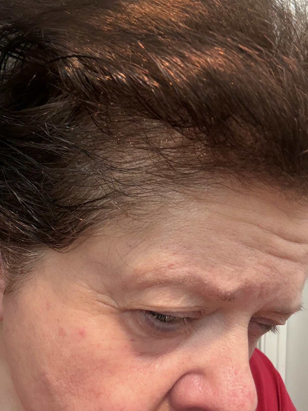 Nioxin Hair Thickening Serum | Night Density Rescue Serum | Density Defend Diamax Advanced | For Thicker, Fuller-Looking Hair | Against Breakage customer photo 1
