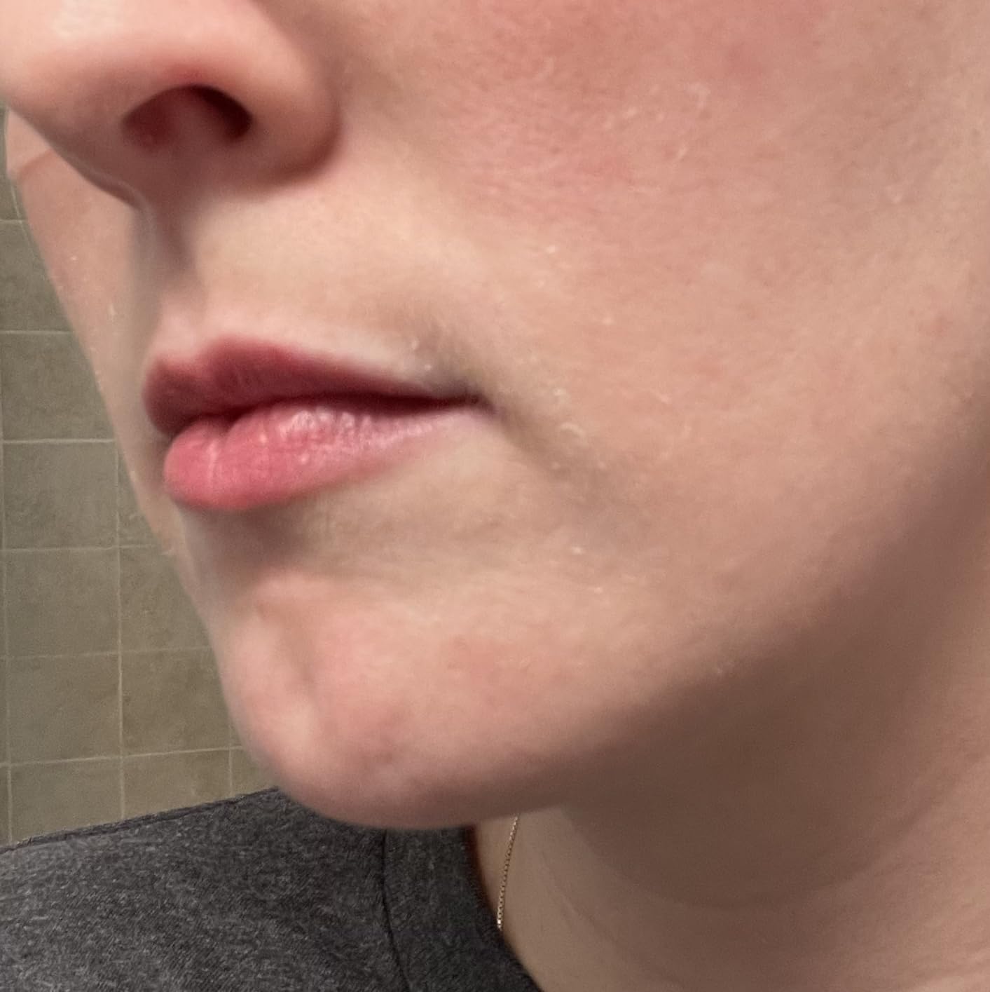 ISDIN Isdinceutics Hyaluronic Concentrate Hydrating Face Serum, 1 fl oz customer photo 2