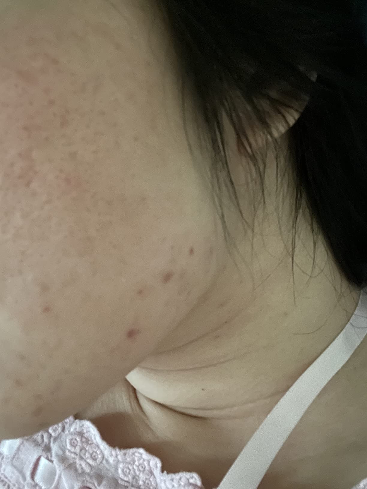 Niacinamide 12% Serum for Face w/Zinc & Hyaluronic Acid - Vitamin B3 & E Pore Minimizer for Dark Spot Corrector, Even Skin Tone, Oil Control, Brightening & Hydrating for Women, 2 Fl Oz customer photo 1