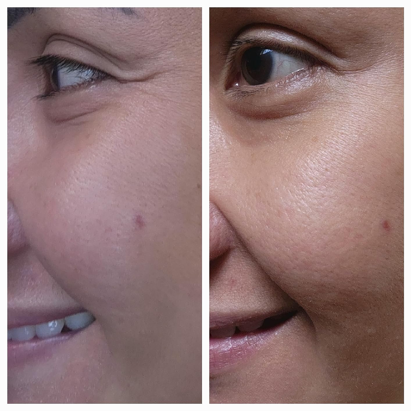 RoC Multi Correxion Hyaluronic Acid Anti Aging Under Eye Cream for Puffiness & Dark Circles (.5 OZ) + Retinol Capsules (7 CT), Skin Care Routine Set customer photo 1