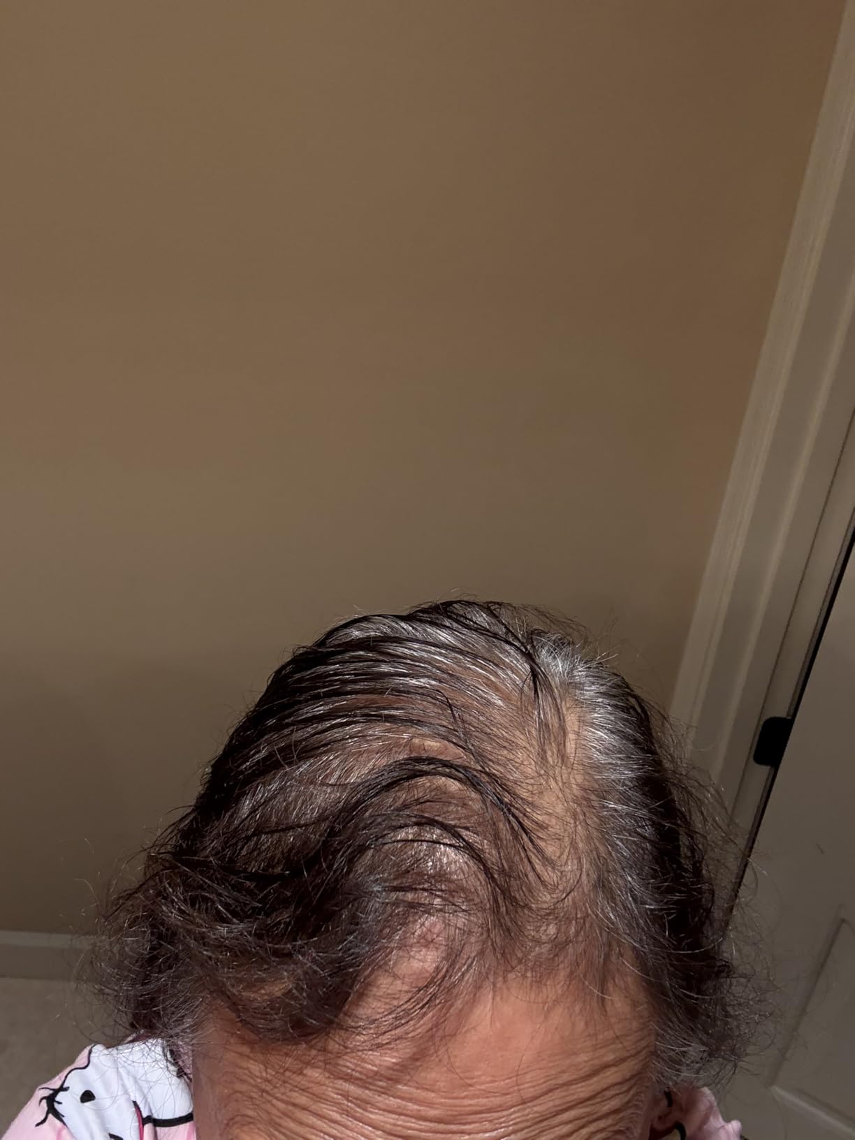 The INKEY List Caffeine Stimulating Scalp Treatment 5.07 fl oz | Leave-In Scalp Serum with Caffeine And Redensyl to Support The Natural Hair Growth Cycle and Softer-Feeling Hair customer photo 2