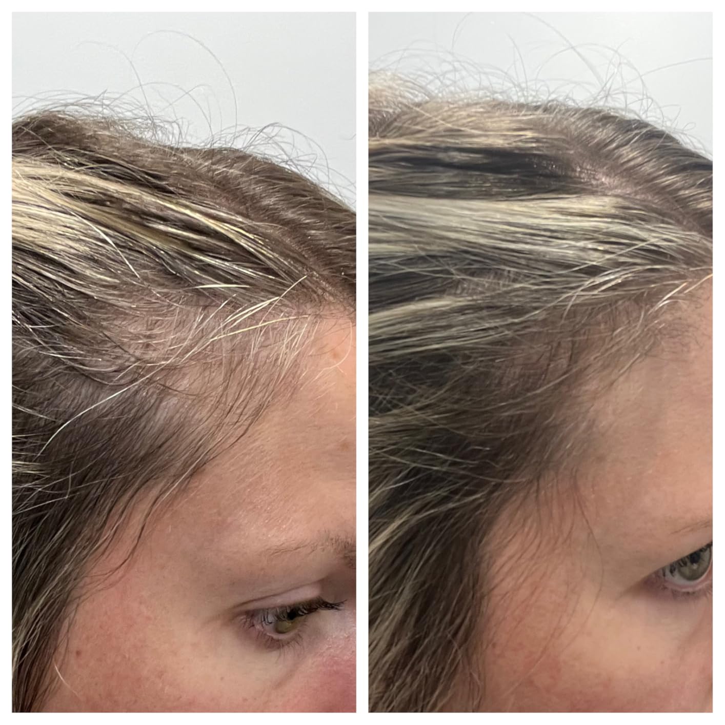 Divi Scalp Serum | To Promote Fuller-Looking Hair with Peptides | 30ml customer photo 2