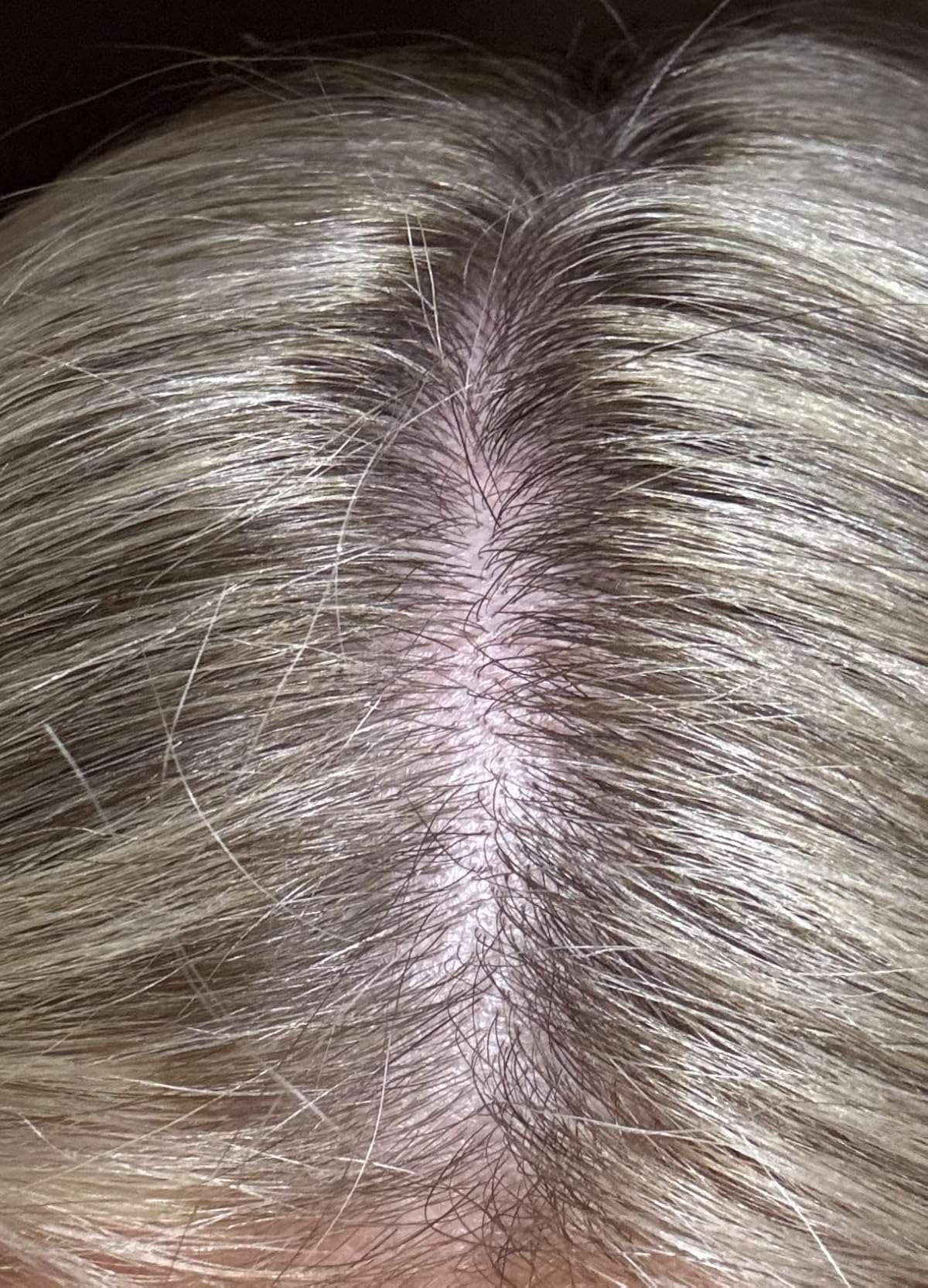 Biotin | Collagen | Hyaluronic Acid | Keratin - Hair Growth & Strength Support Vitamins - Skin & Nails Supplement - Clinically Tested for Men & Women - 25000mcg Vitamins B1, B2, B3, B6 & B7 - 60 Caps customer photo 1