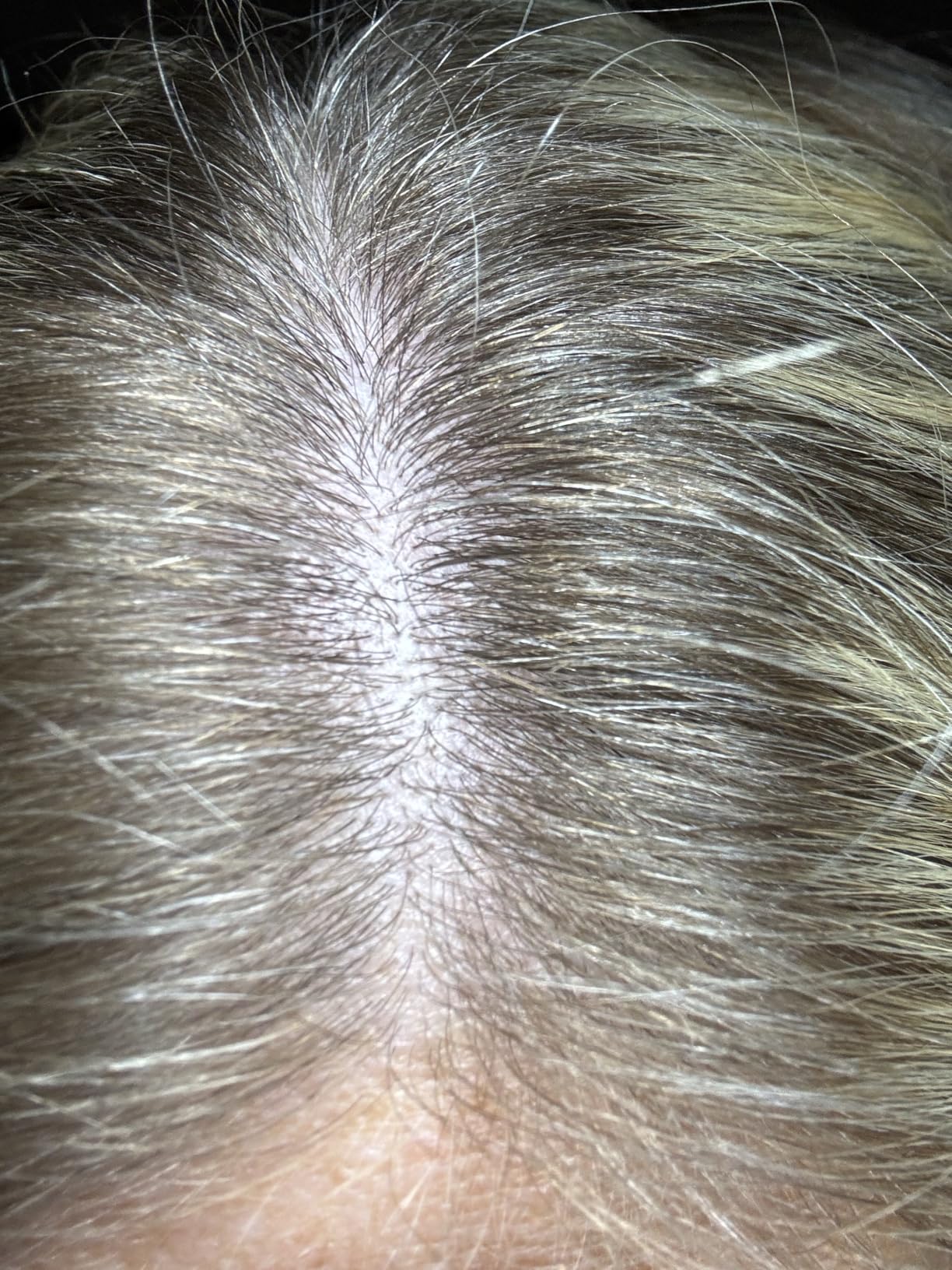 Biotin | Collagen | Hyaluronic Acid | Keratin - Hair Growth & Strength Support Vitamins - Skin & Nails Supplement - Clinically Tested for Men & Women - 25000mcg Vitamins B1, B2, B3, B6 & B7 - 60 Caps customer photo 2