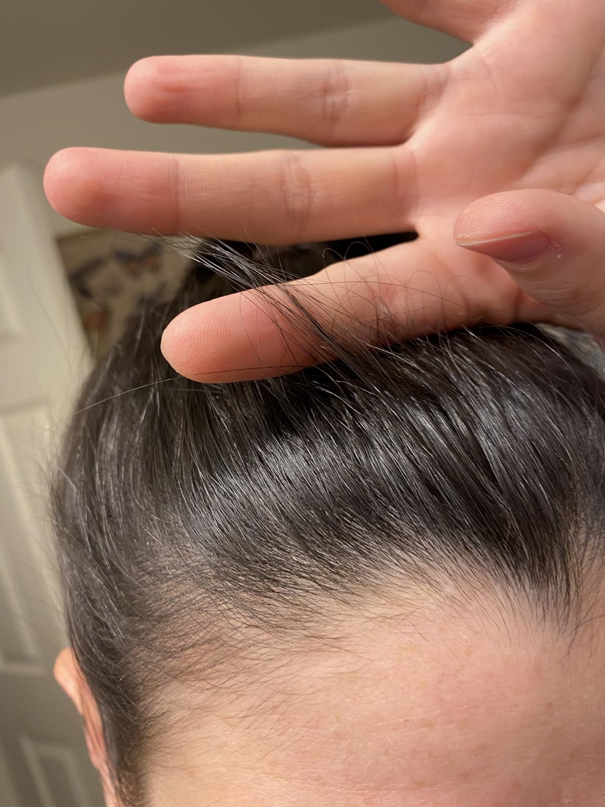 Pacifica Scalp Detox Tonic - Scalp Exfoliator with Glycolic & Salicylic Acid customer photo 1