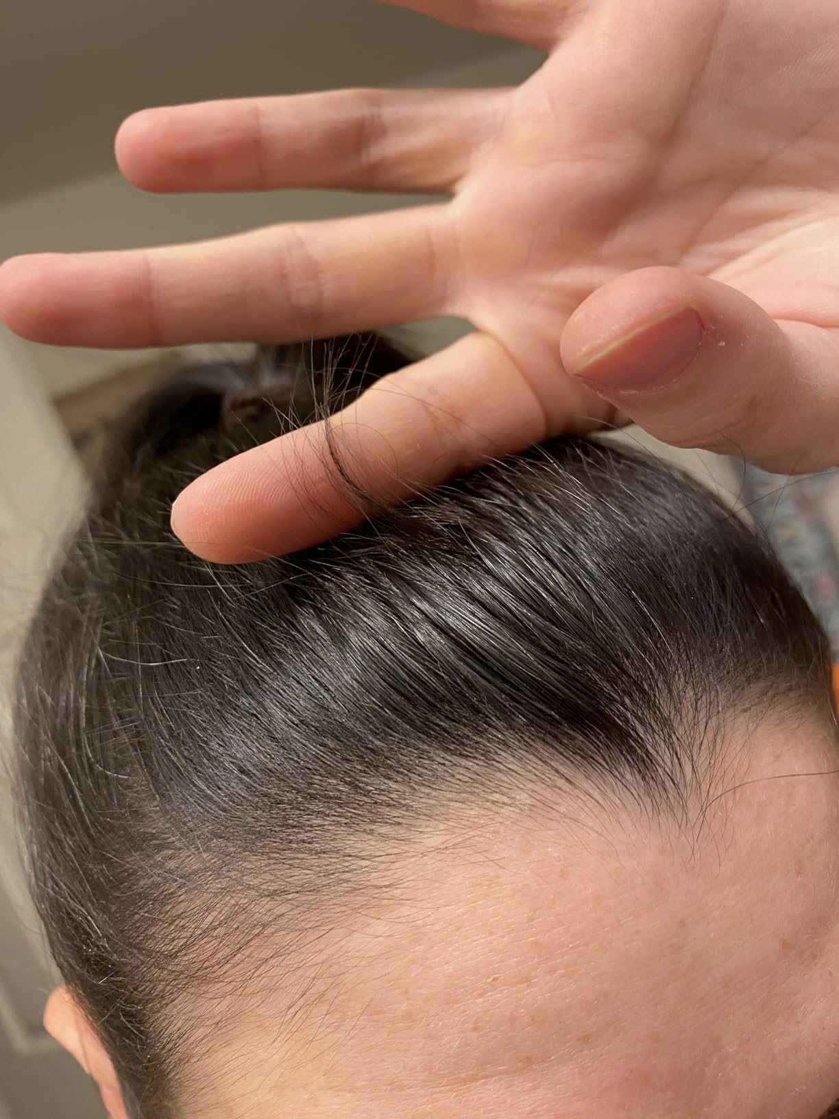 Pacifica Scalp Detox Tonic - Scalp Exfoliator with Glycolic & Salicylic Acid customer photo 2