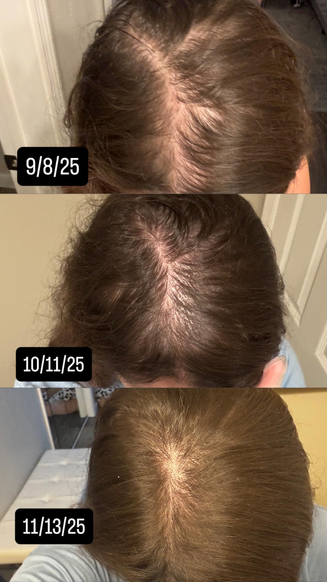 The Ordinary Multi-Peptide Serum for Hair Density, Peptide-Powered Formula for Thicker, Fuller Looking Hair customer photo 2