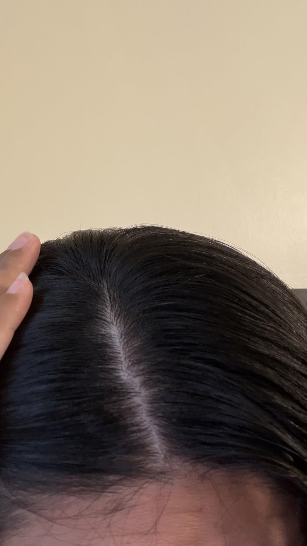 The Ordinary Hair Care Natural Moisturizing Factors + Hyaluronic Acid, Lightweight Hydrating Scalp Serum with Hyaluronic Acid and Squalane, 2 Fl Oz customer photo 1
