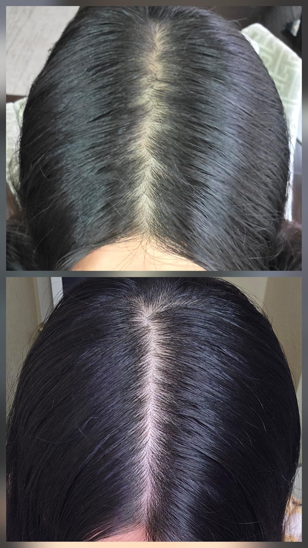 OUAI Scalp Serum - Balancing Hair Serum (2 Fl Oz) | With Red Clover Extract, Siberian Ginseng & Peptides, for Thicker, Fuller-Looking Hair, Sulfate Free Scalp Care customer photo 2