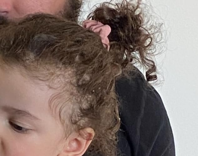 Natural Baby Kids Hair Care Products - Extra Strength Growing & Nourishing Serum with Black Seed Oil for Powerful Thick, Full Hair Growth customer photo 1