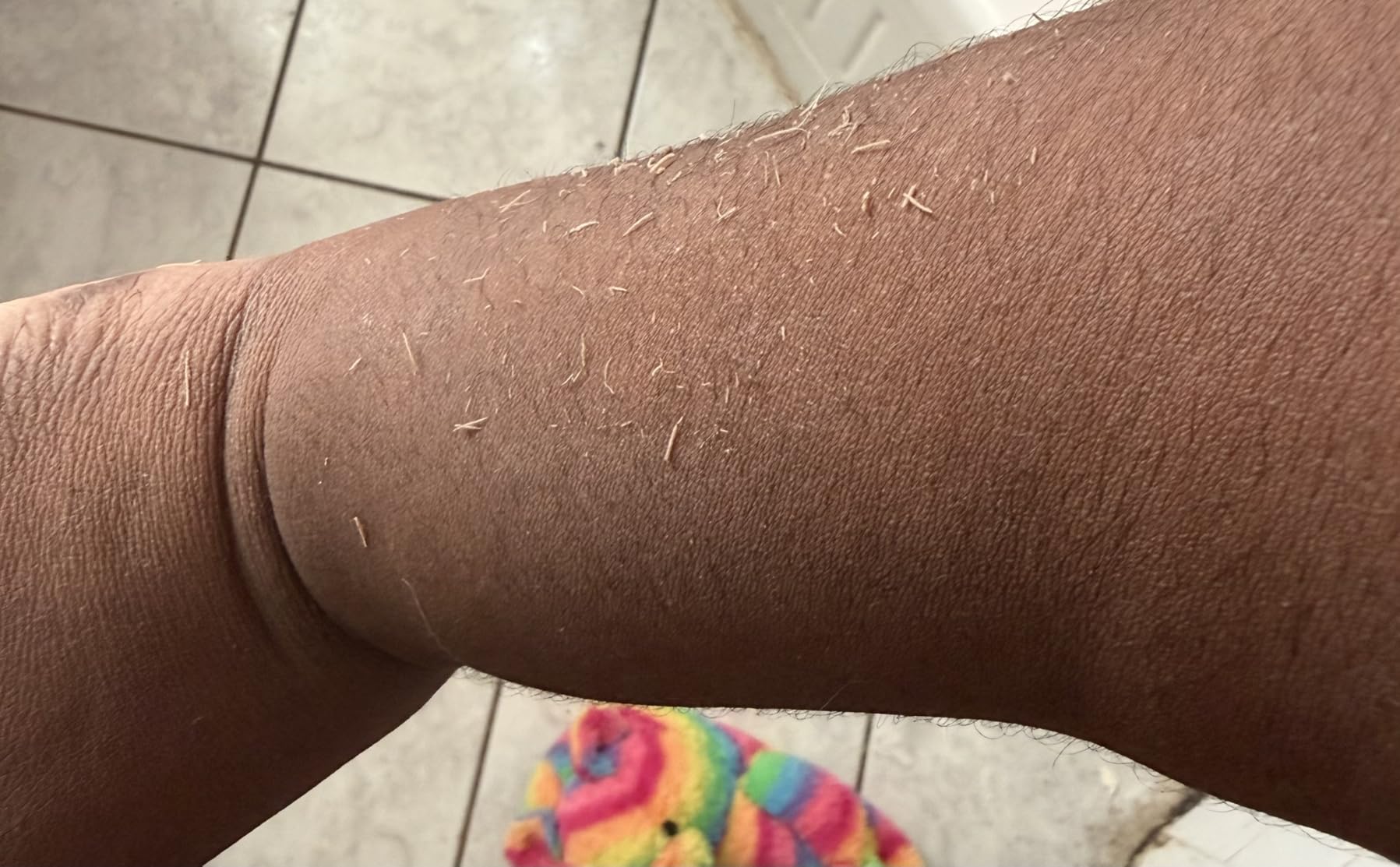 L'Exfose Kessa Hammam Deep Exfoliating Glove 2x - Korean Exfoliating Mitt for shower - Ideal for Dead Skin Remover, Keratosis Pilaris & Self-Tanning to Improve Skin Tone Made with 100% Natural Viscose customer photo 2