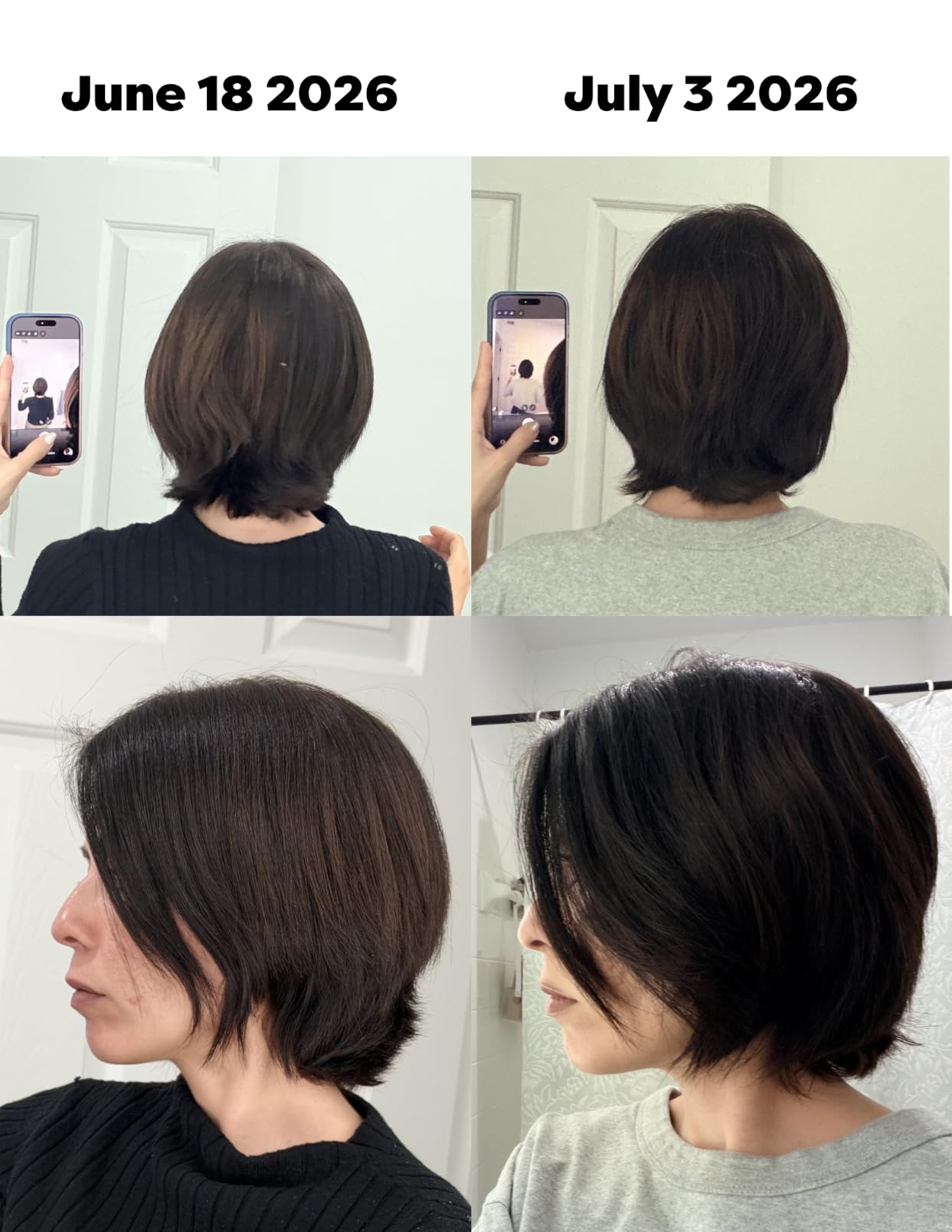 Dr. Groot Hair Thickening Shampoo, Korean Hair Care with Biotin, Rosemary Oil to Help Volumize Thinning, Damaged Hair, Hydrate Hair and Scalp, Biotin Shampoo, Scalp Revitalizing Solution customer photo 1