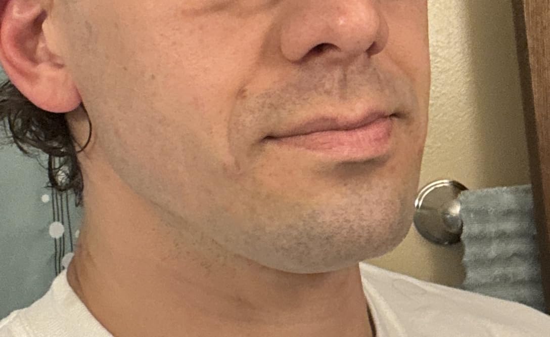 Philips Norelco Shaver 2400 Series, Wet and Dry Electric Shaver, Pop-up Trimmer, P-Cap, Deep Black, Model X3001/90 customer photo 1