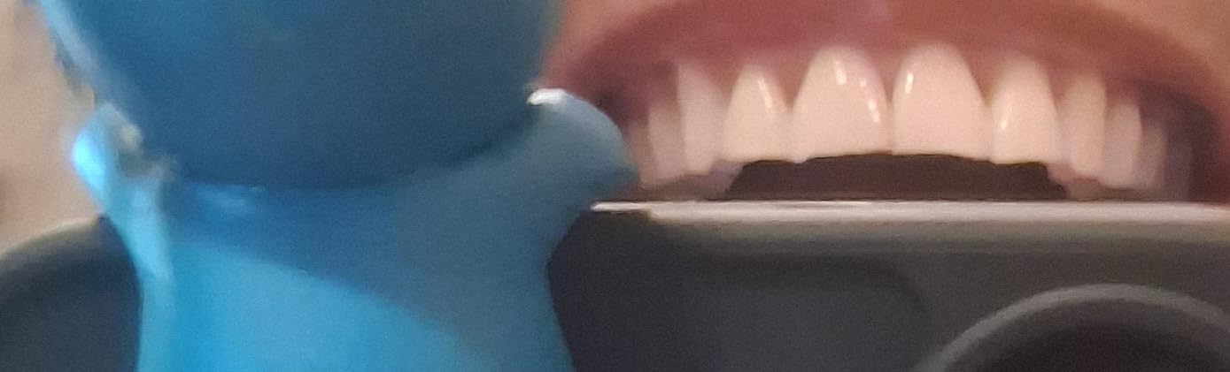 Crest 3D Whitestrips Sensitive & Gentle + LED Light - Teeth Whitening Kit, 1 Light + 14 Treatments, 28 Strips customer photo 1