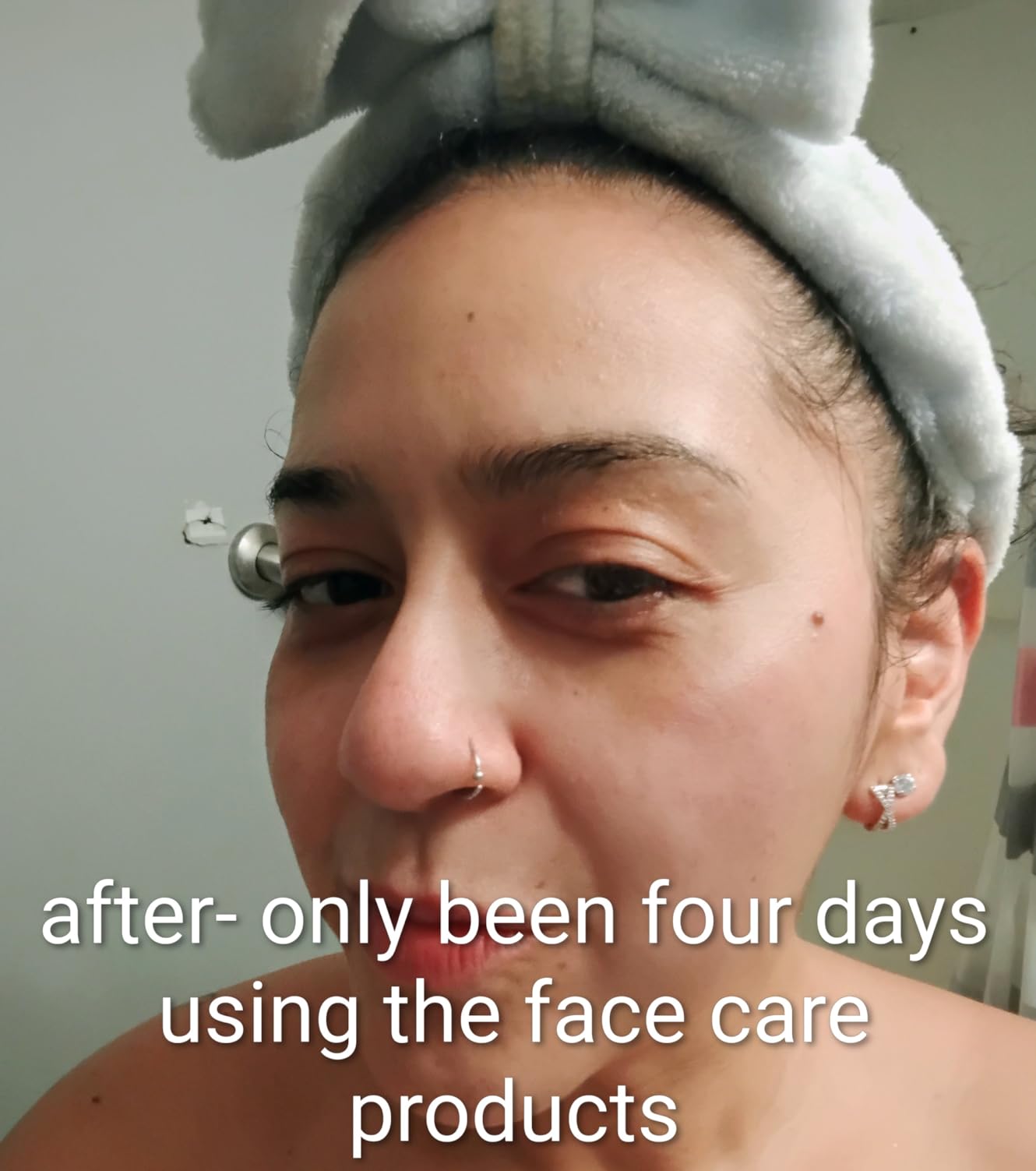 Collagen Skin Care Set, 6Pcs Face Care Sets for Older Women, Firming Skin, Shrink Pores, Smooth Wrinkles, Hydrating Skin Care Set Include Serum Face Cream Eye Cream Toner Cleanser Facial Mask customer photo 2