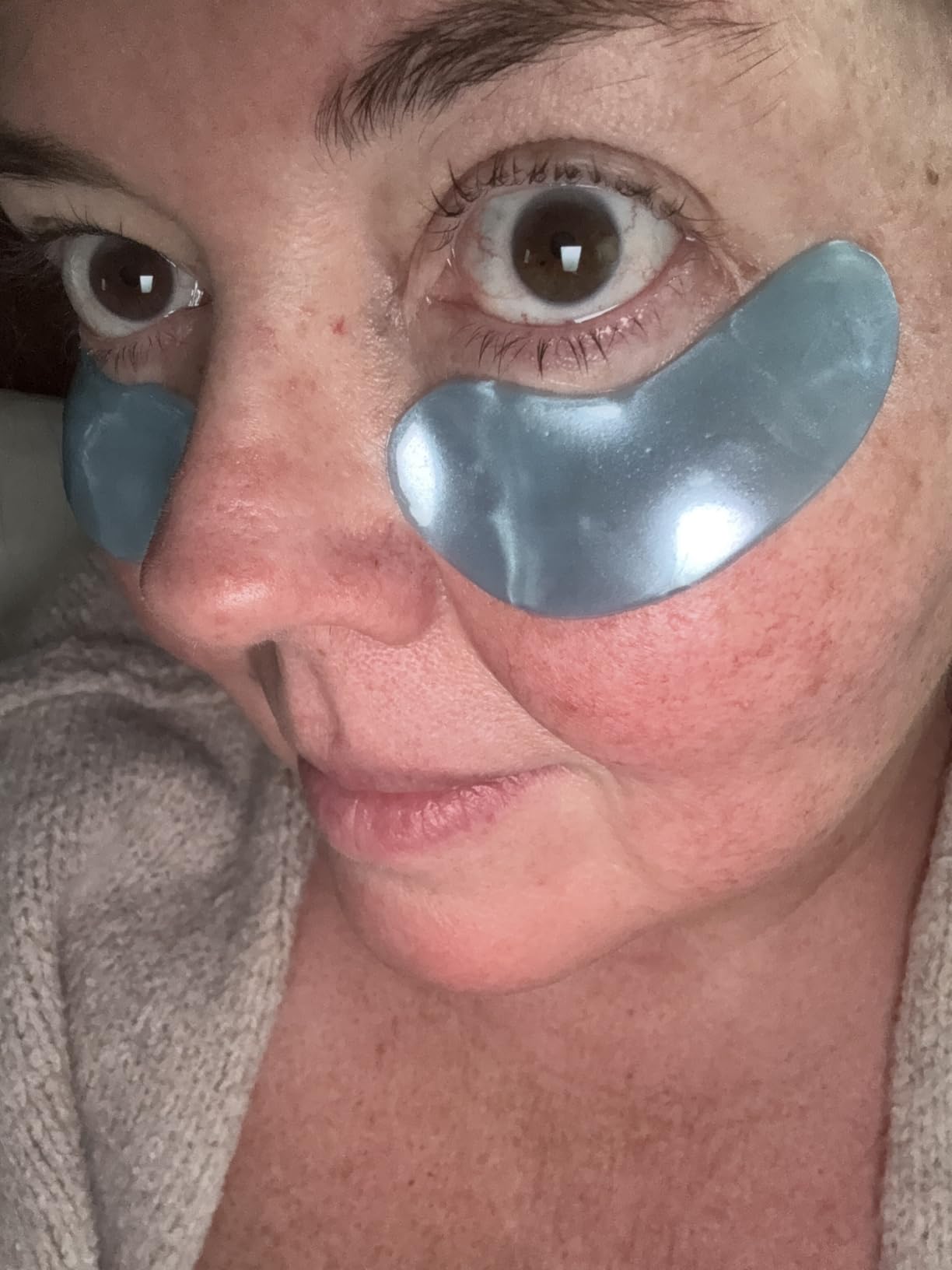 grace & stella Under Eye Patches Eye Masks for Puffy Eyes and Dark Circles | Gifts for Women, Bridesmaids, Birthdays, Bachelorette Party, Self Care Gifts for Women - Vegan Cruelty-Free (12 Pairs) customer photo 2