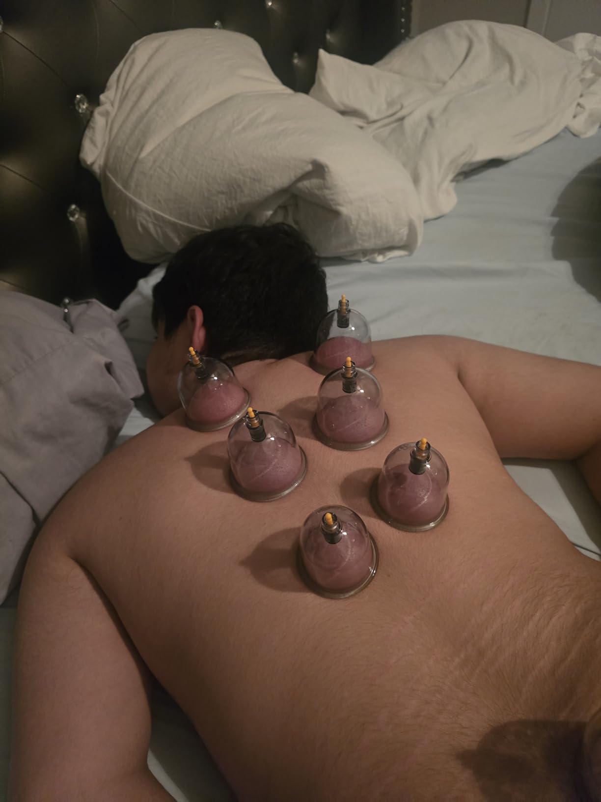 Cupluw Cupping Set, 24 Cups Cupping Kit for Massage Therapy, Chinese Cupping Therapy Set with Magnetics, Professional Vacuum Cupping Set for Cellulite Reduction Muscle Pain Relief with Manual Pump customer photo 1