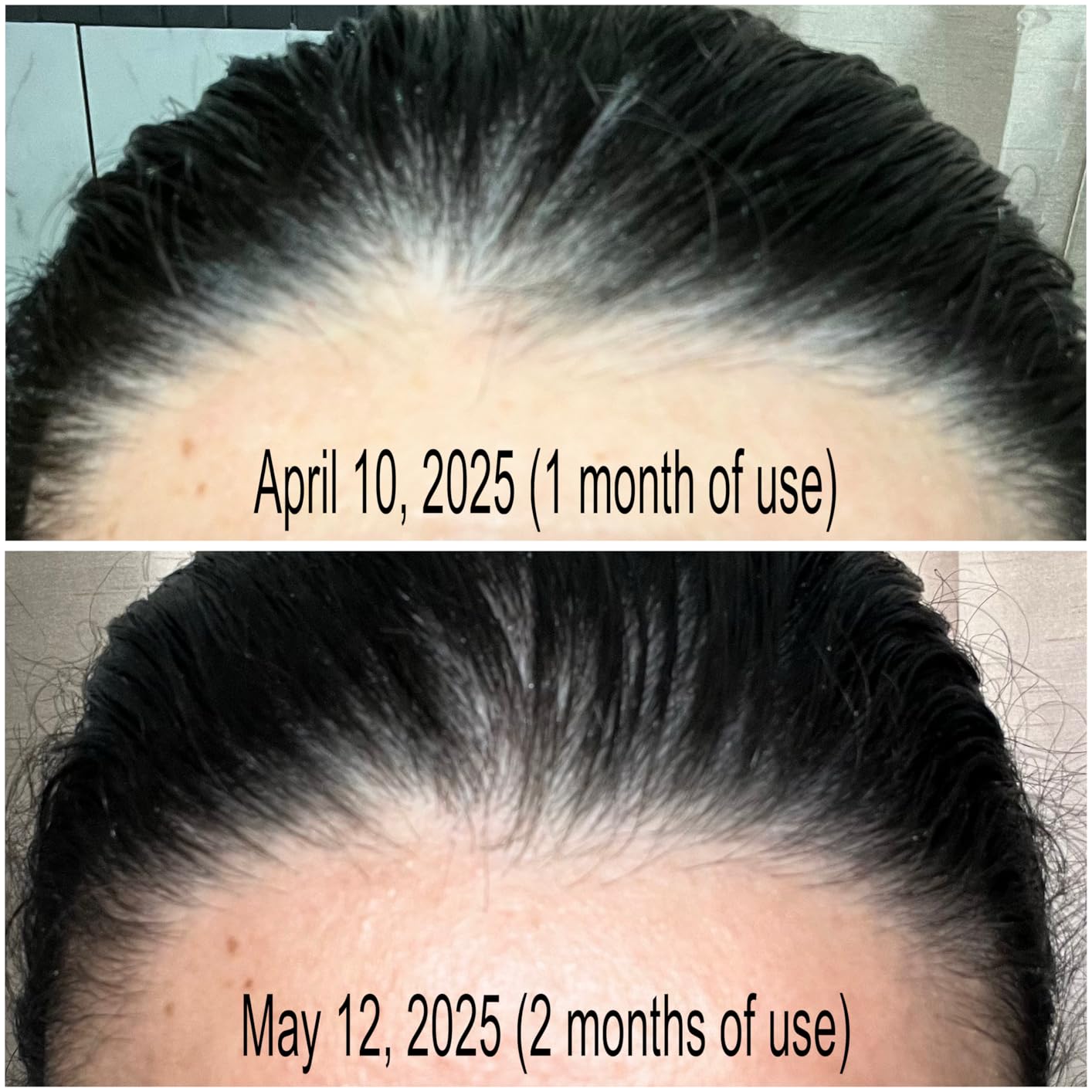 OGX Extra Strength Refreshing Scalp + Rosemary Oil Mint Dry Scalp Treatment, Peppermint & Witch Hazel Scalp Detox, Clarifying Leave-In to Help Remove Buildup and Refresh, Shiny Hair Finish, 4 fl oz customer photo 2