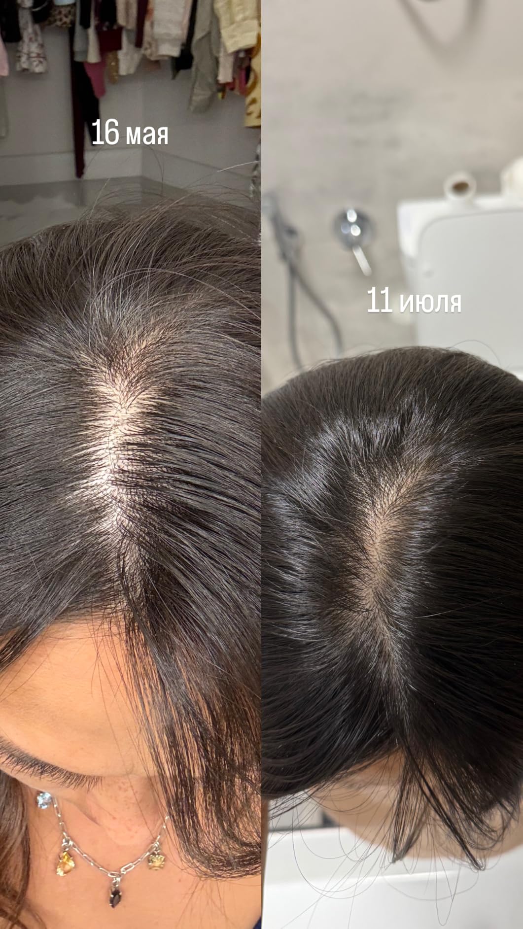 PURA D'OR Scalp & Hair Strengthening Oil Supports Optimal Growth, Reduce Breakage, Nourish Roots for Healthier, Fuller, Thicker Hair - Rosemary, Castor & Peppermint Oil: 3.3 Oz Ayurvedic Hair Care customer photo 2