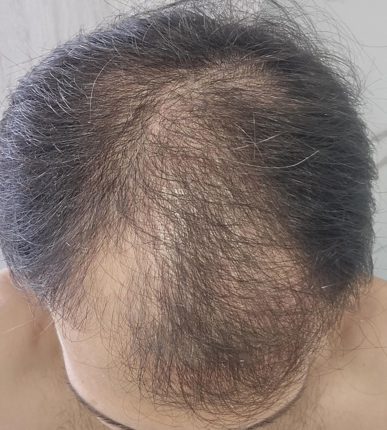 DS Laboratories Revita Hair Density Shampoo for Thinning Hair, Color Safe, 100 mL | Powered by peptides, caffeine & amino acids to support scalp wellness and healthier-looking, fuller-looking hair customer photo 1