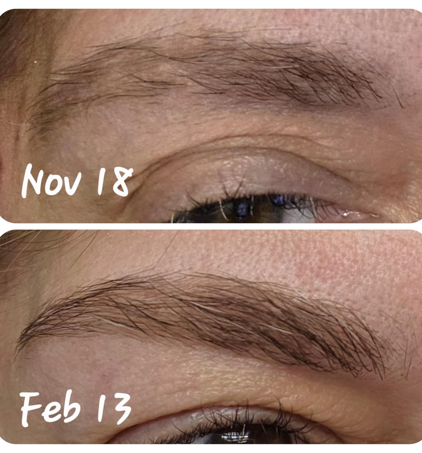 RevitaLash Cosmetics, RevitaBrow Advanced Eyebrow Conditioner, Serum, Physician Developed & Cruelty-Free customer photo 1