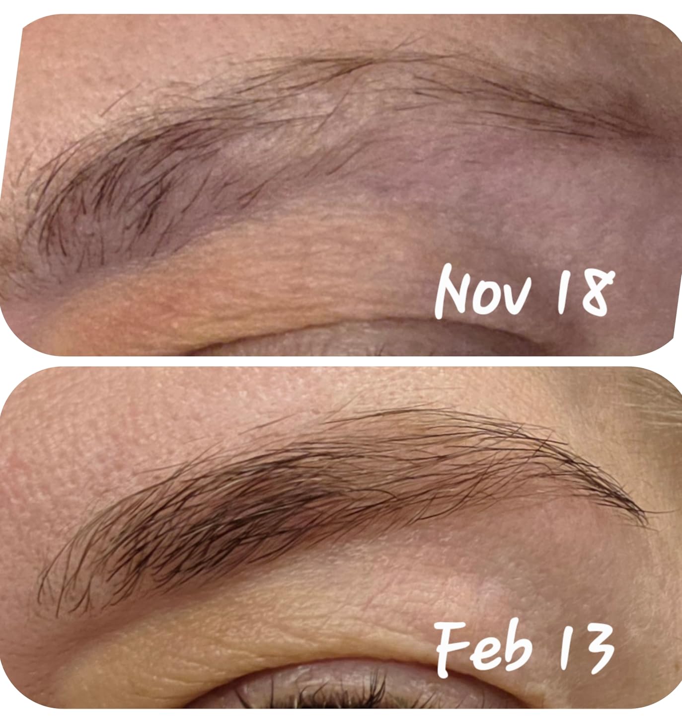 RevitaLash Cosmetics, RevitaBrow Advanced Eyebrow Conditioner, Serum, Physician Developed & Cruelty-Free customer photo 2