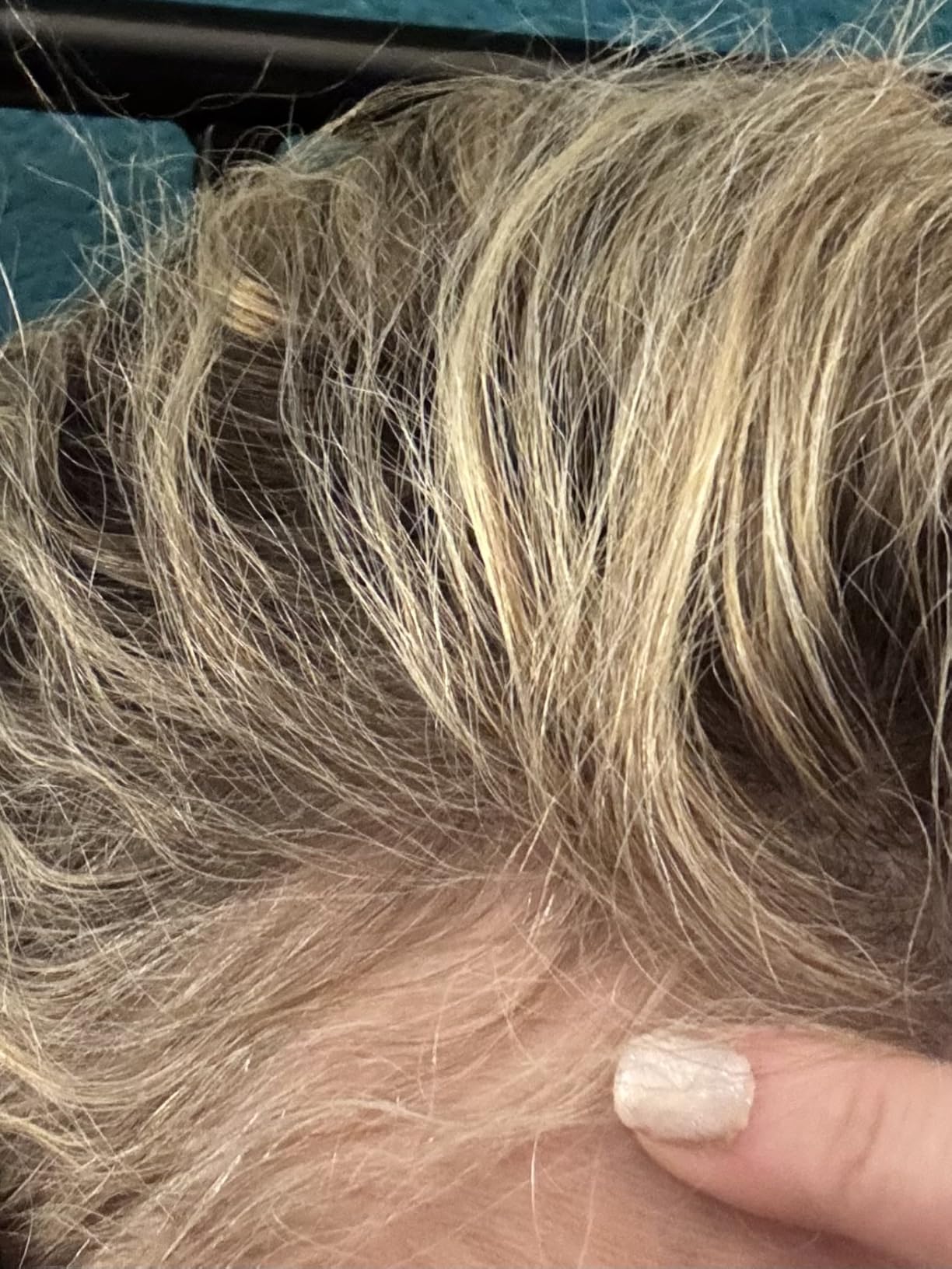 John Frieda ULTRAfiller+ Hair Density Scalp Serum for Fine Hair, Volumizing Hair Serum, Scalp Treatment for Thickening for Women and Men, 2 Oz customer photo 2