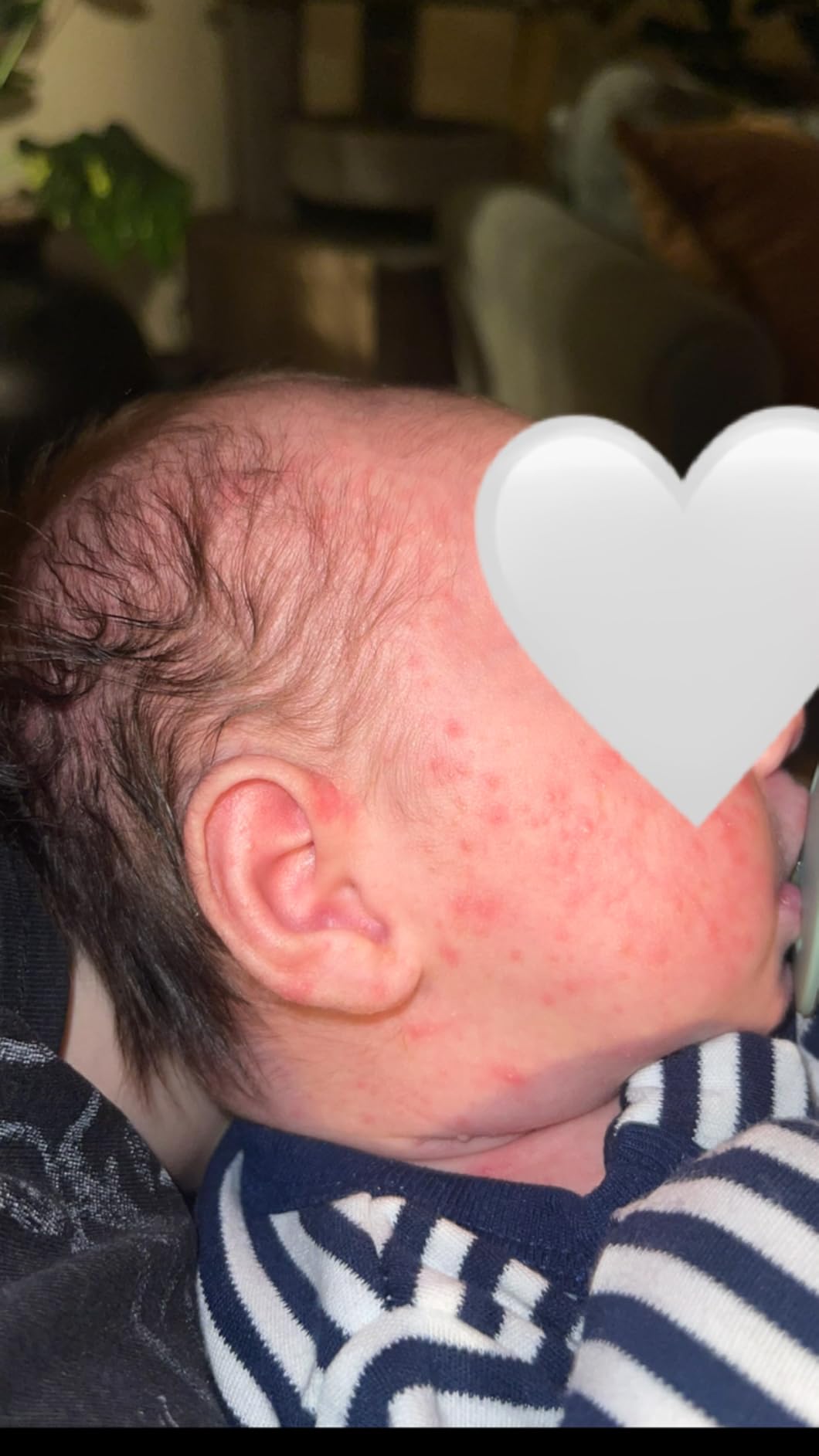 TUBBY TODD Cradle Cap Baby Hair Treatment Kit | Includes Bye-Bye Cradle Cap Gel, Cradle Cap Silicone Brush, & 3.5 oz All Over Ointment customer photo 1