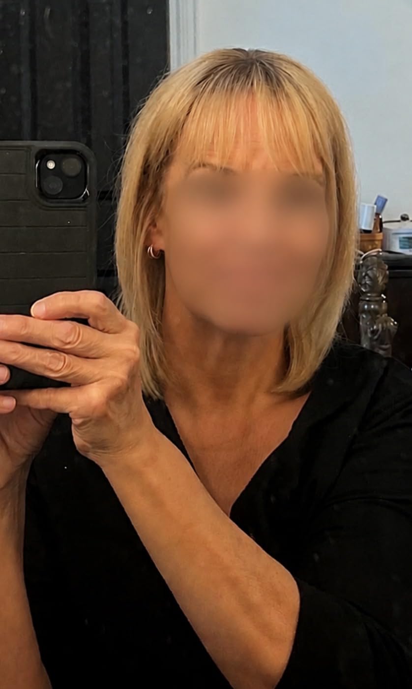 YAMI Hair Toppers for Women Real Human Hair Toppers for Women with Thinning Hair Topper with Bangs (Honey Blonde with Dark Brown Root) customer photo 1