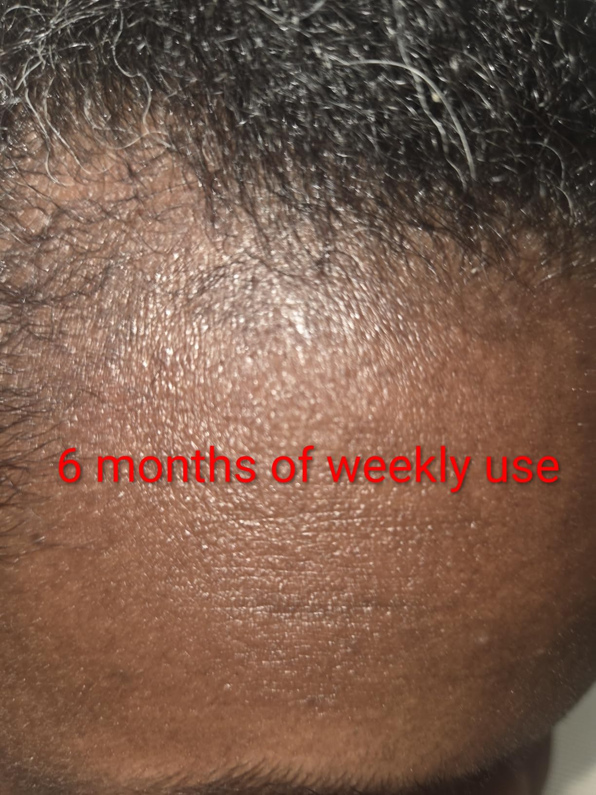 CeraVe Hydrating Anti Dandruff Shampoo, 1% Pyrithione Zinc Dandruff Treatment With Ceramides, Niacinamide & Hyaluronic Acid, Helps Eliminate Flakes & Provides Itchy Scalp Relief, Sulfate Free, 12 Oz customer photo 1